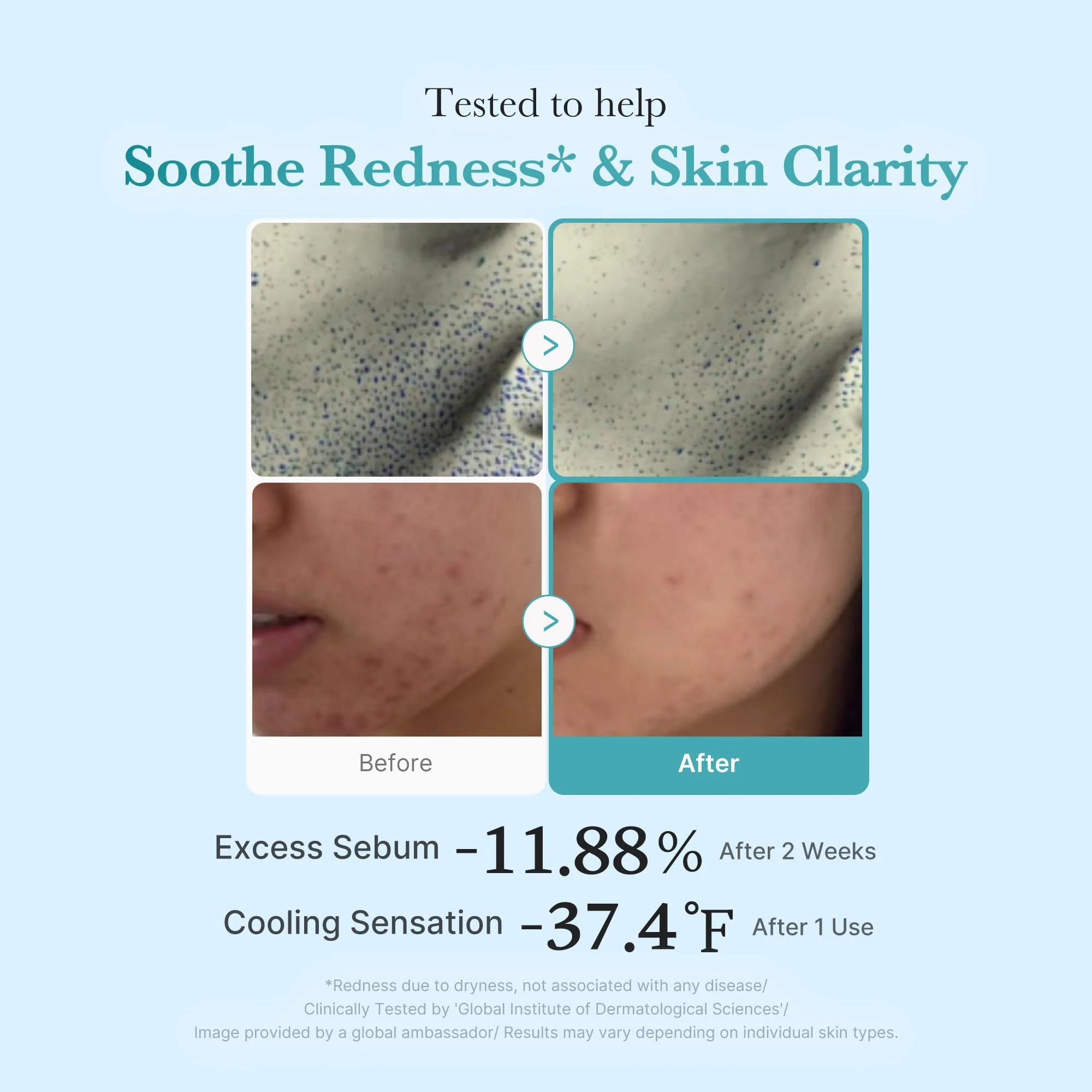 medicube Azelaic Acid Niacinamide Clarifying Toner | Troubled Skin Care, Ideal for Purifying & Calming | 4% Azelaic Acid & 2% Niacinamide| Soothing Daily Toner | Korean Skin Care | 8.45 fl.oz - Image 7