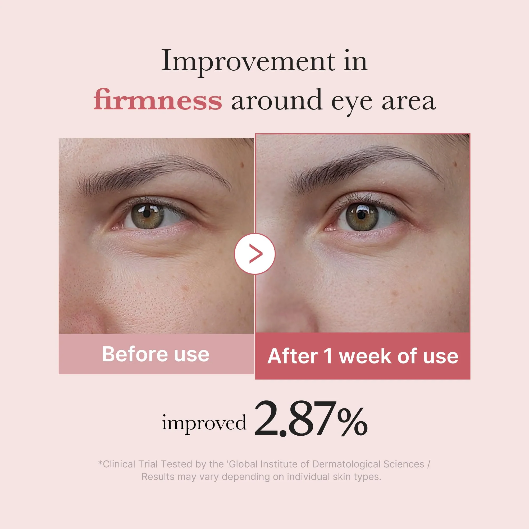 medicube Eye Serum with Salmon DNA PDRN & Pink Peptides | 99% Purity Retinol for Fine Lines | PDRN & Niacinamide for Uneven Skin Tone | Korean Skincare, 1.01 fl.oz - Image 6