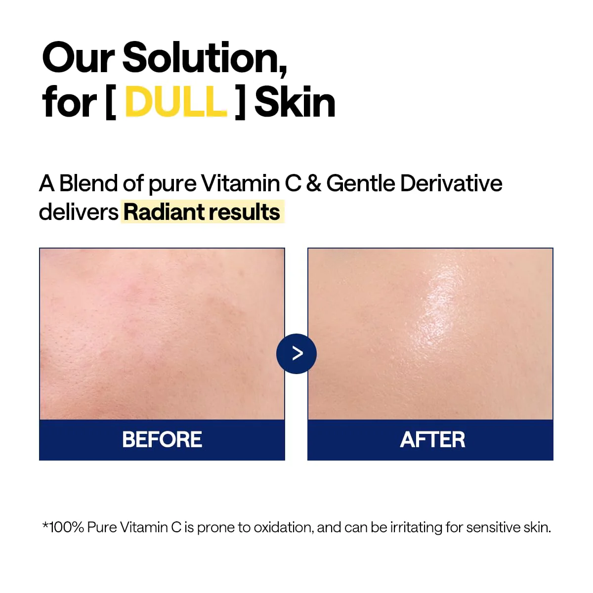 MEDIHEAL Vitamin C Brightening Serum (1.35 fl oz, 1 Pack) - Tone-Texture-Glow Care, Manage Skin with Vitamin C, Niacinamide, Hyaluronic Acid - Image 3