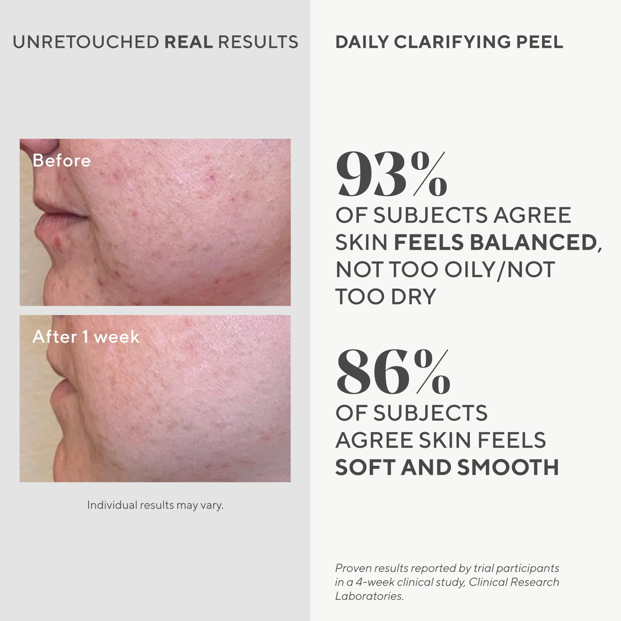 Murad Daily Clarifying Peel – Retinoid, Salicylic and Glycolic Acid, AHA/BHA Exfoliating Liquid Solution for Softer, Smoother, Hydrated, Pore-Refined Skin – 3.2 Fl Oz - Image 7