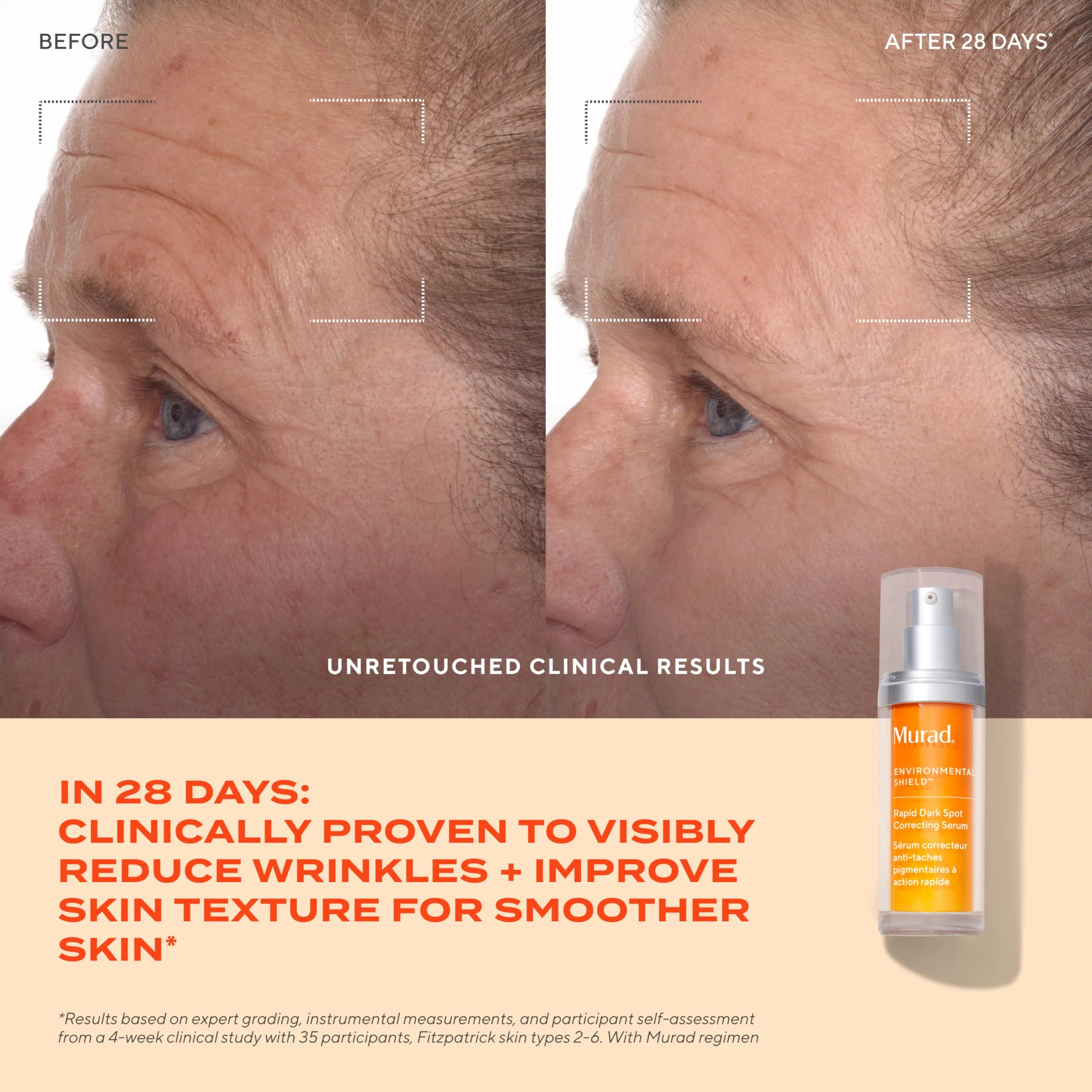 Murad Rapid Dark Spot Correcting Serum - Advanced Anti-Aging Formula with Patented Resorcinol Technology, Tranexamic and Glycolic Acids for Hyperpigmentation, Dark Spots and Dull Skin - 1 Fl Oz - Image 10