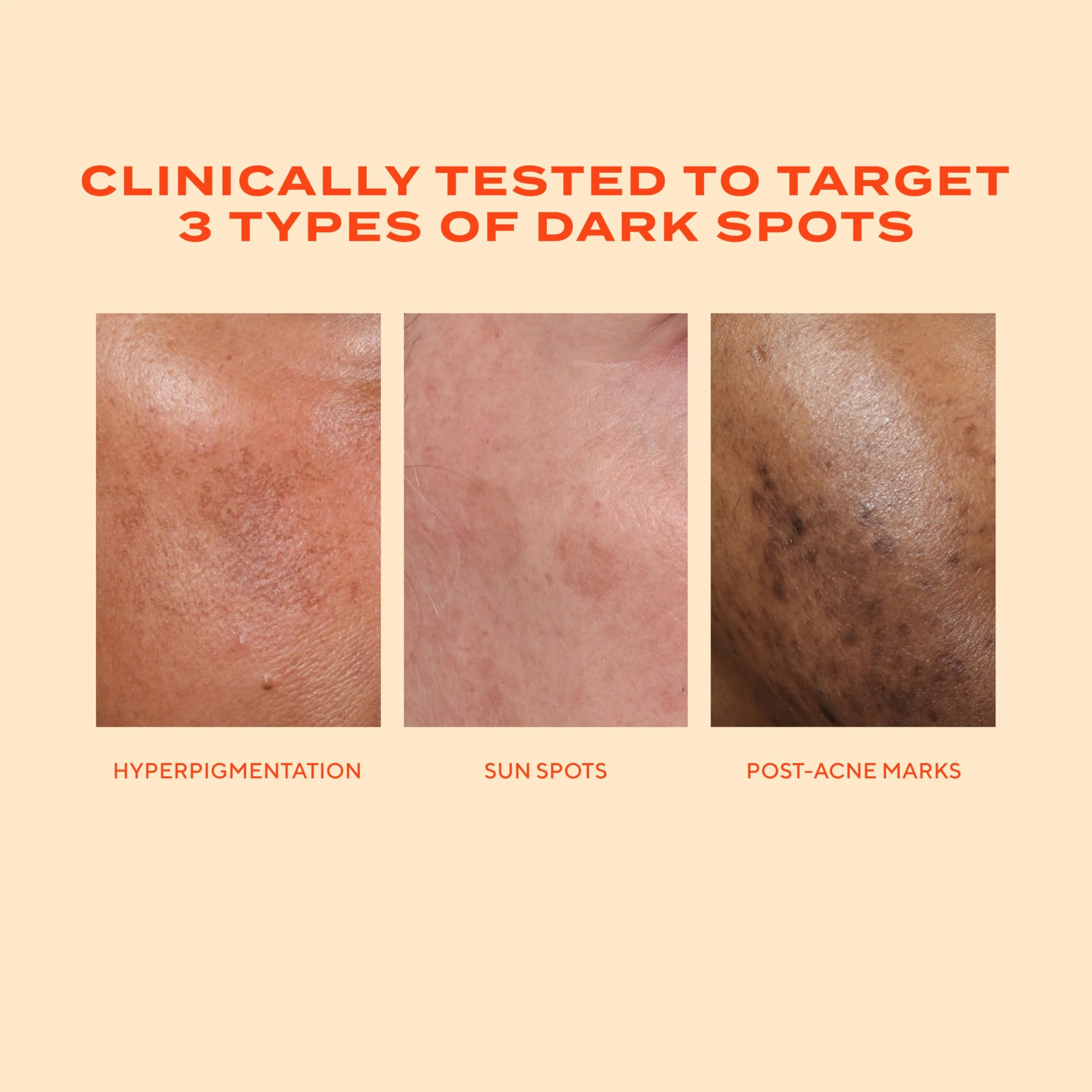 Murad Rapid Dark Spot Correcting Serum - Advanced Anti-Aging Formula with Patented Resorcinol Technology, Tranexamic and Glycolic Acids for Hyperpigmentation, Dark Spots and Dull Skin - 1 Fl Oz - Image 8
