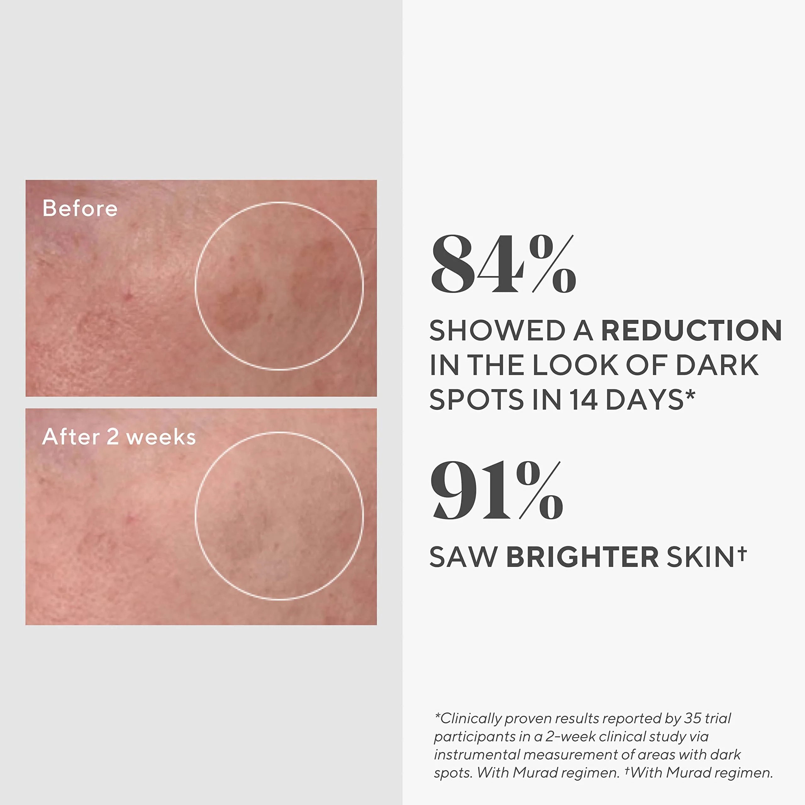 Murad Rapid Dark Spot Correcting Serum - Skin Brightening Face Serum for Hyperpigmentation - Glycolic Acid Treatment Backed by Science, Travel Size 0.33Fl Oz - Image 6