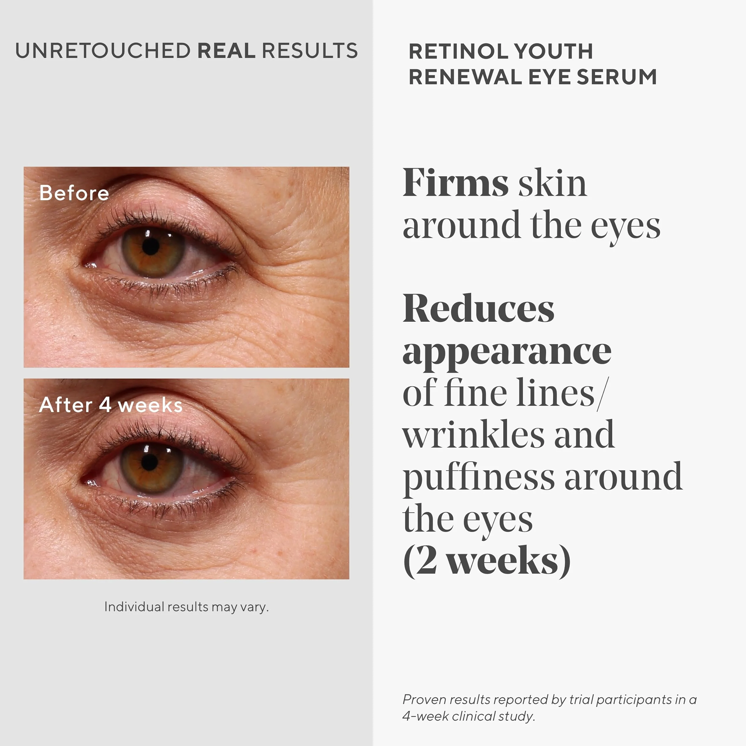 Murad Retinol Youth Renewal Eye Serum - Retinol Eye Serum Visibly Improves Undereye Puffiness Dark Circles and Reduces the Appearance of Fine Lines, Gentle Enough for Nightly Use - 0.5 oz - Image 7