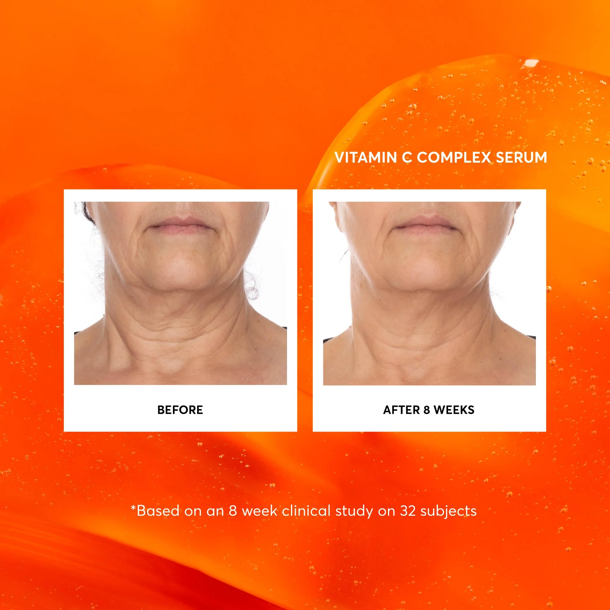 Naturium Vitamin C Complex Face Serum, Anti-Aging Facial Treatment with Hyaluronic Acid & Vitamin E, 1 oz - Image 5
