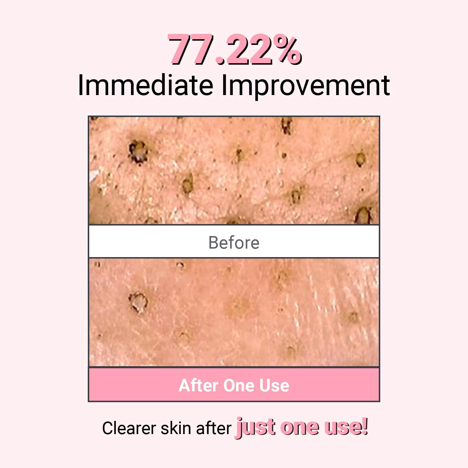 NEAF NEAF Kaolin Purifying Wash Off Pack, Pore Cleansing Mask for Dry Sensitive Skin, Softening and Hydrating, Korean Skincare (3.88oz / 110g) - Image 5