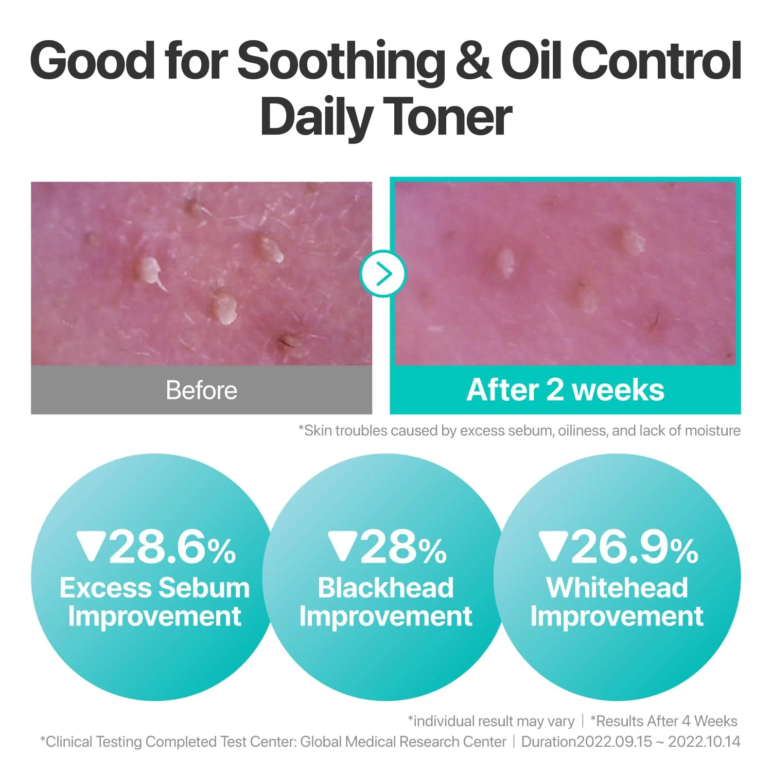 numbuzin No.1 Toner | Pure-Full Calming Herb Toner | Breakouts, Redness, Excess Oil Control | Centella Asiatica, Heartleaf, Licorice Root | Acne-Prone, Sensitive Skin | 10.14 fl. oz. - Image 9