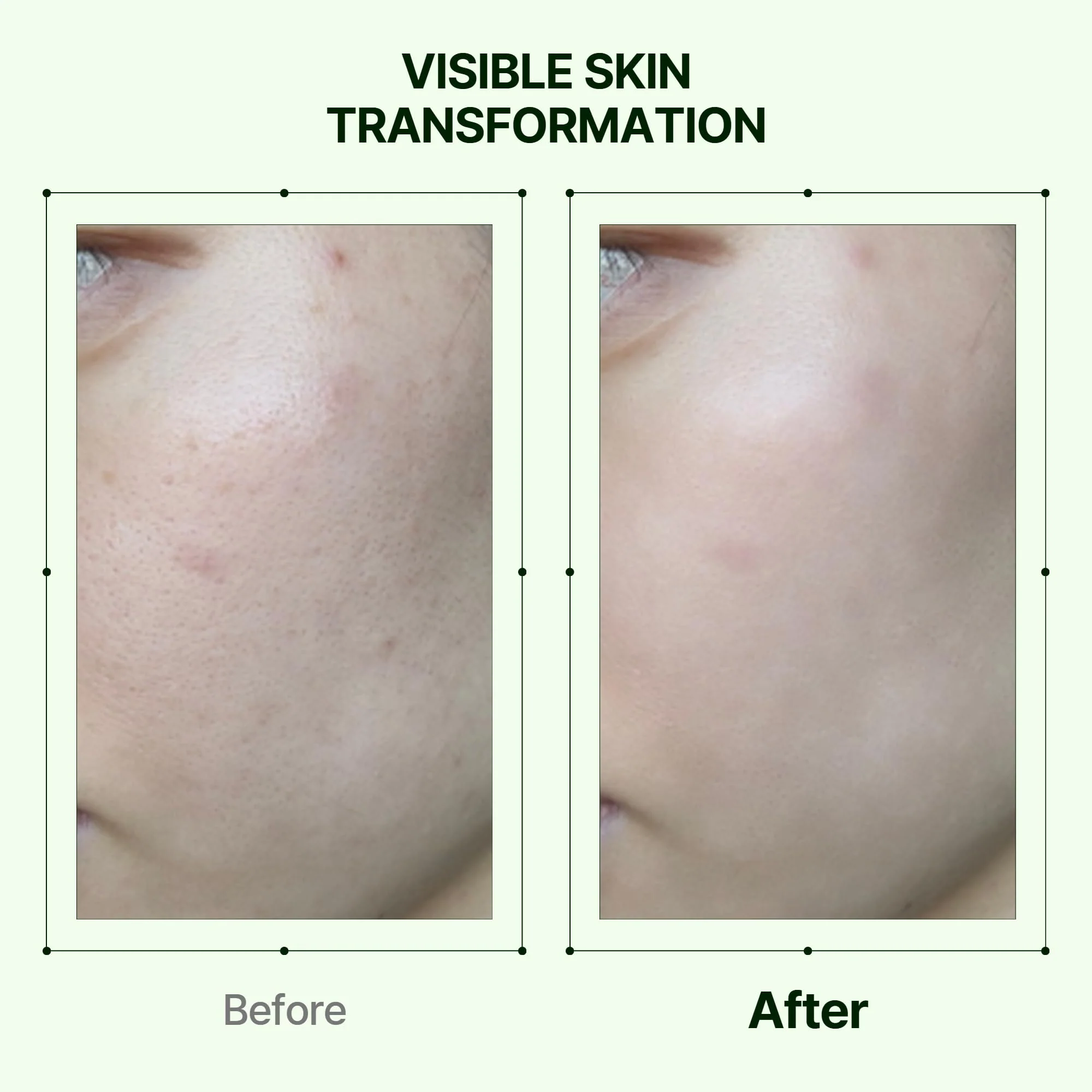 Orien Propolis Niacinamide Glow Serum 1.01 fl.oz. - Image 4