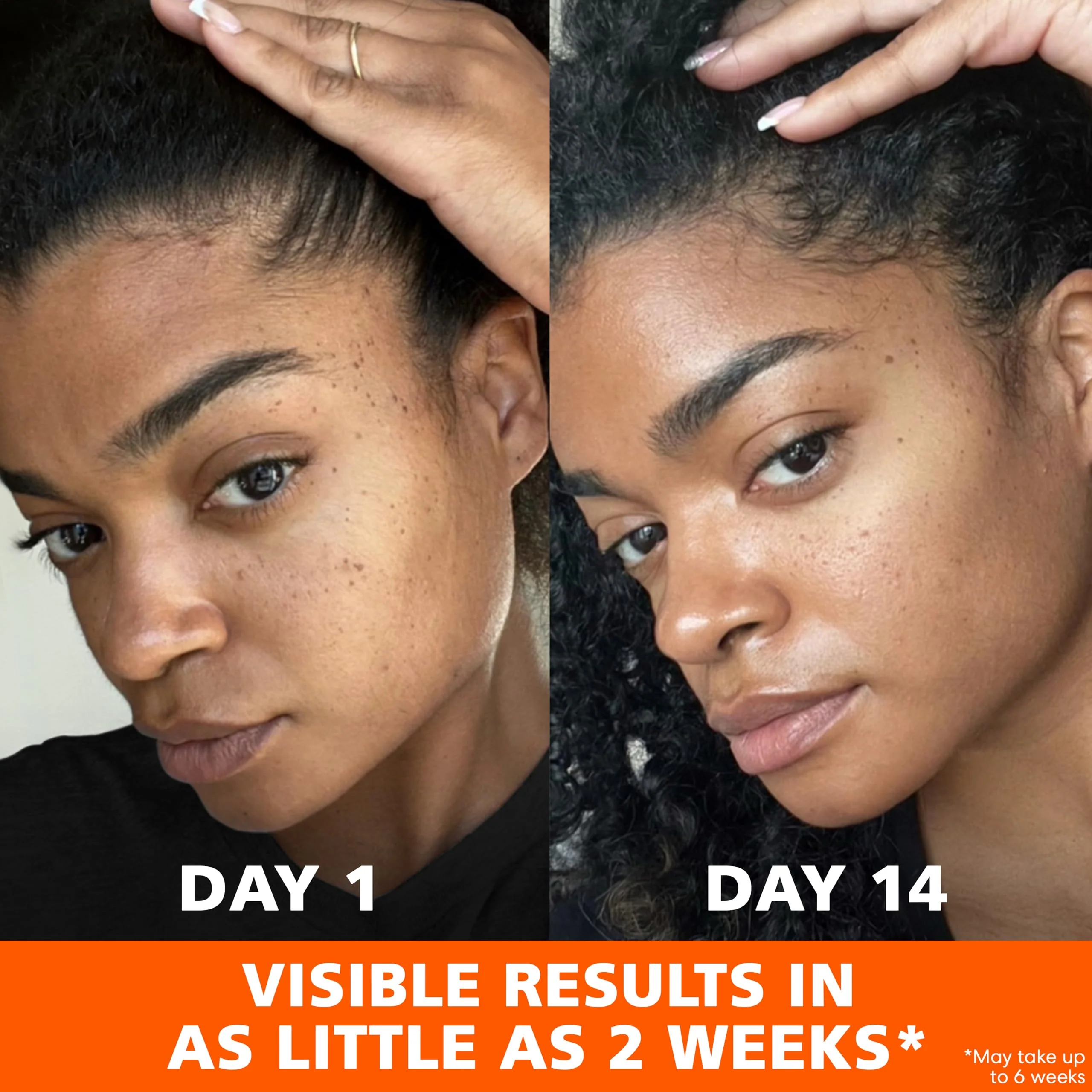 Palmer's Skin Success Anti-Dark Spot Fade Cream with Vitamin E and Niacinamide, for All Skin Types 2.7 Ounce - Image 11