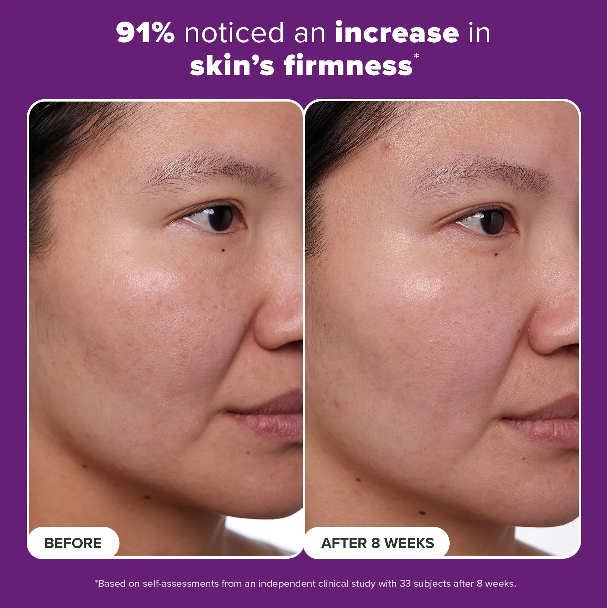 Paula's Choice CLINICAL 1% Retinol Treatment Cream with Peptides, Vitamin C & Licorice Extract, Anti-Aging & Wrinkles, Travel Size. PACKAGING MAY VARY. - Image 6