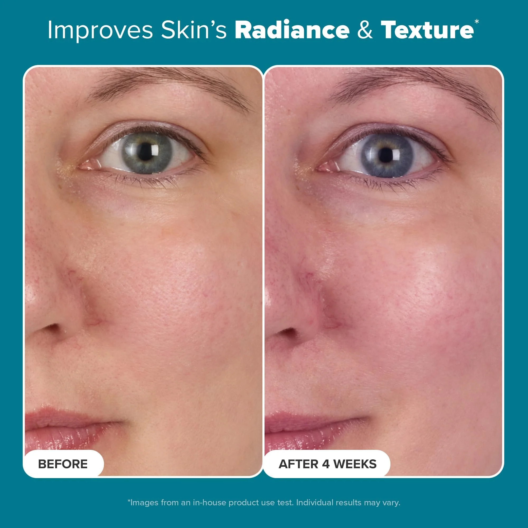 Paula's Choice Skin Balancing Pore-Reducing Face Toner with Niacinamide, for Oily Skin & Combination, Minimizes Large Pores, Controls Oil & Shine, Hydrates & Replenishes, Fragrance-Free, 6.4oz - Image 7