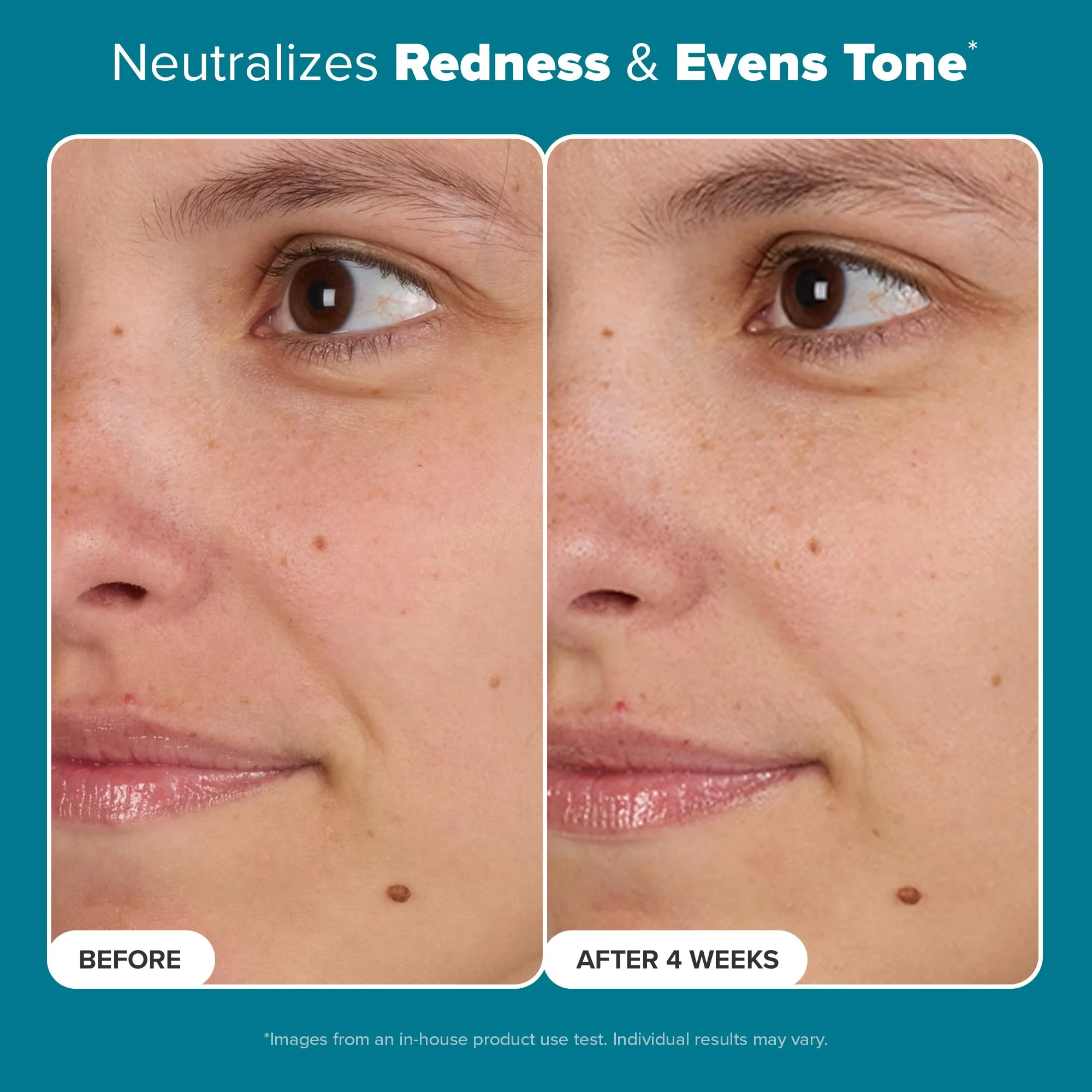 Paula's Choice Skin Balancing Pore-Reducing Face Toner with Niacinamide, for Oily Skin & Combination, Minimizes Large Pores, Controls Oil & Shine, Hydrates & Replenishes, Fragrance-Free, 6.4oz - Image 8