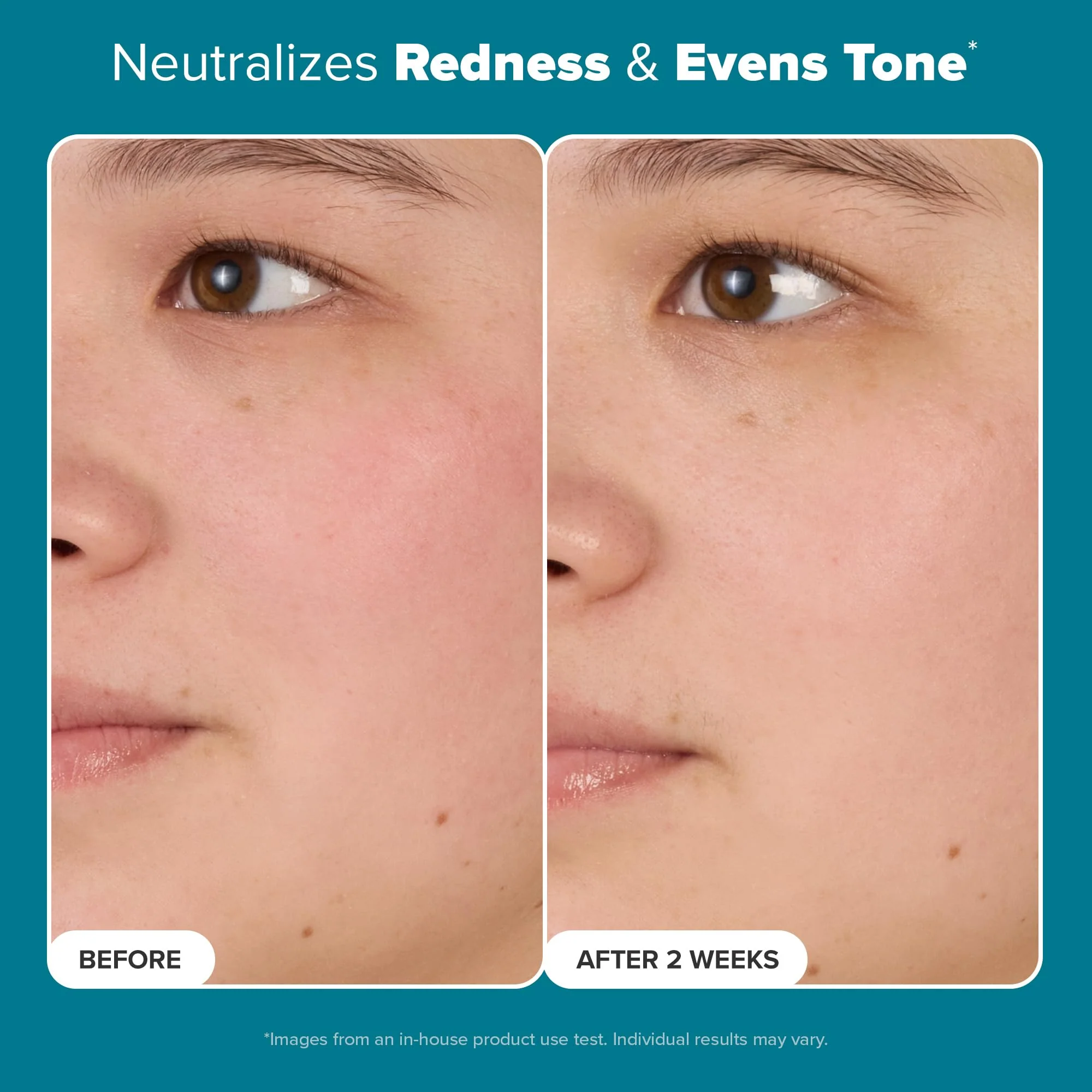 Paula's Choice Skin Balancing Pore-Reducing Face Toner with Niacinamide, for Oily Skin & Combination, Minimizes Large Pores, Controls Oil & Shine, Hydrates & Replenishes, Fragrance-Free, 6.4oz - Image 9