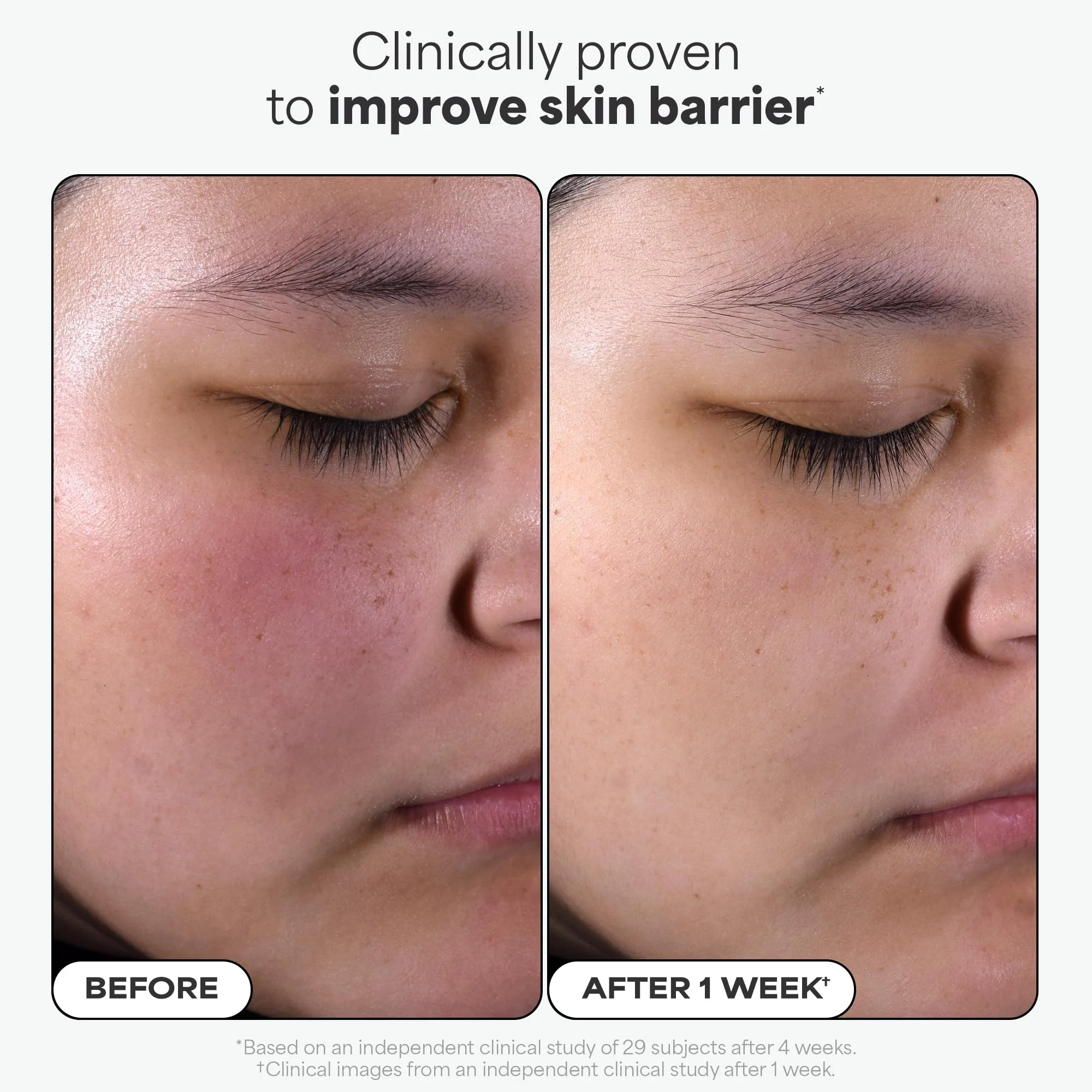 Paulas Choice--SKIN PERFECTING 2% BHA Liquid Salicylic Acid Exfoliant--Facial Exfoliant for Blackheads, Enlarged Pores, Wrinkles & Fine Lines, 4 oz Bottle - Image 6