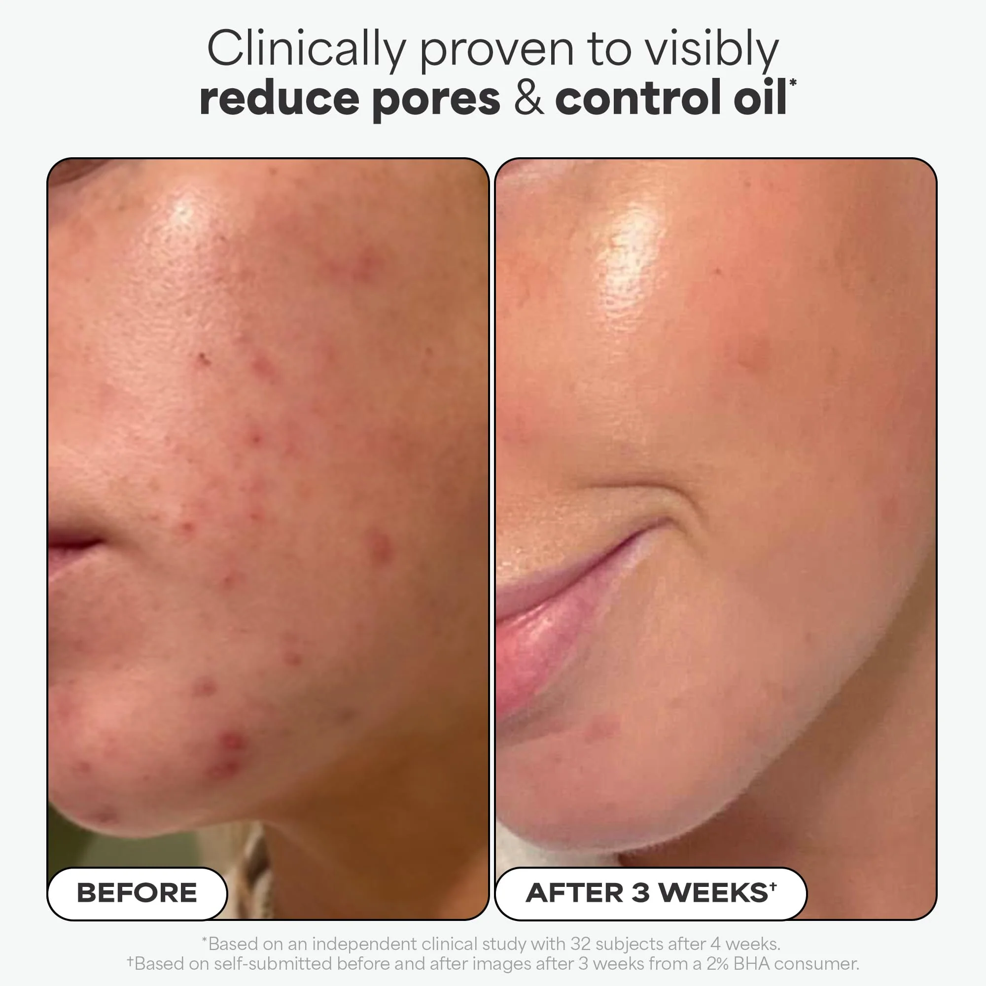 Paulas Choice--SKIN PERFECTING 2% BHA Liquid Salicylic Acid Exfoliant--Facial Exfoliant for Blackheads, Enlarged Pores, Wrinkles & Fine Lines, 4 oz Bottle - Image 7