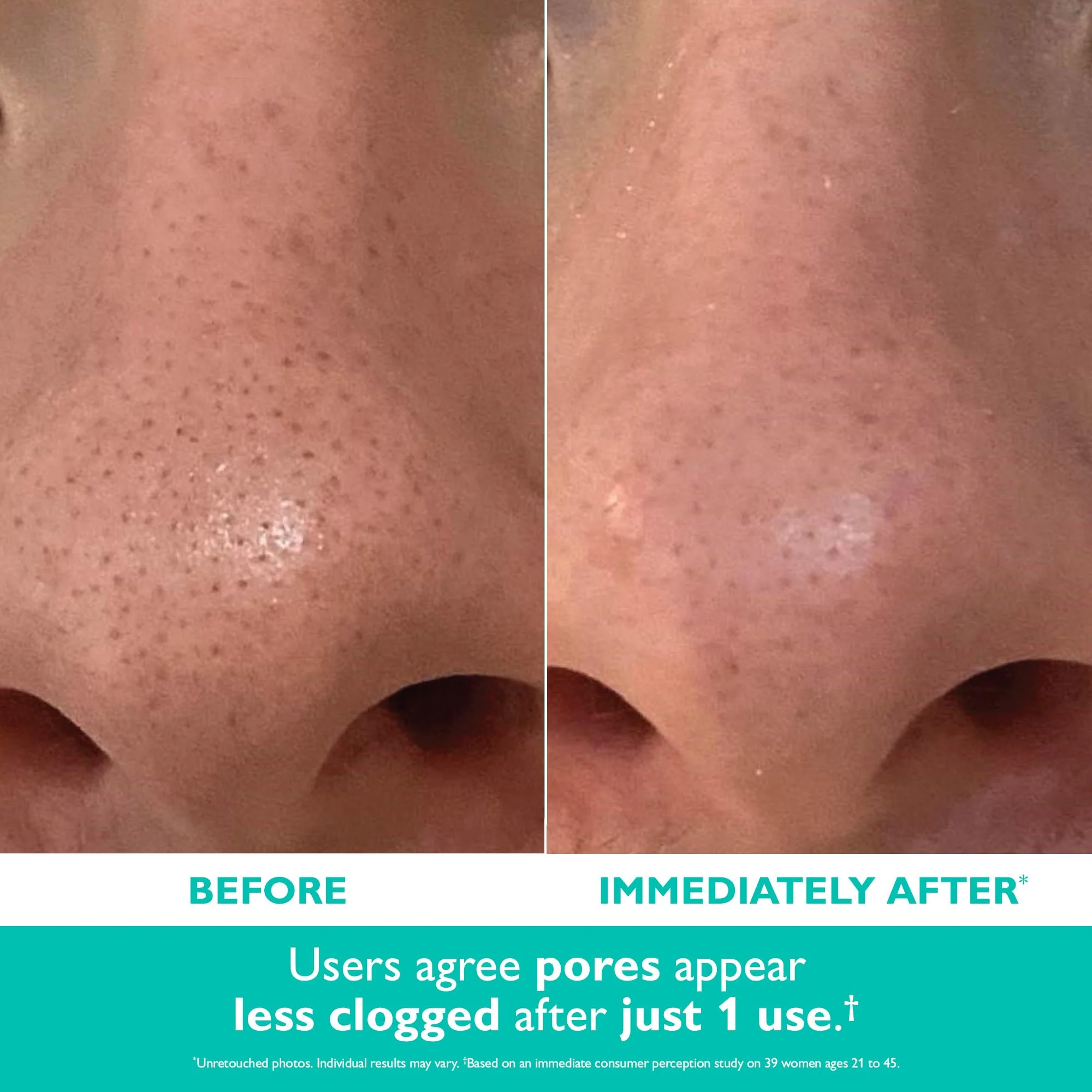 Peter Thomas Roth | Even Smoother™ Microdermabrasion Exfoliating Pore Purifier with Salicylic Acid for Oil Control - Image 9