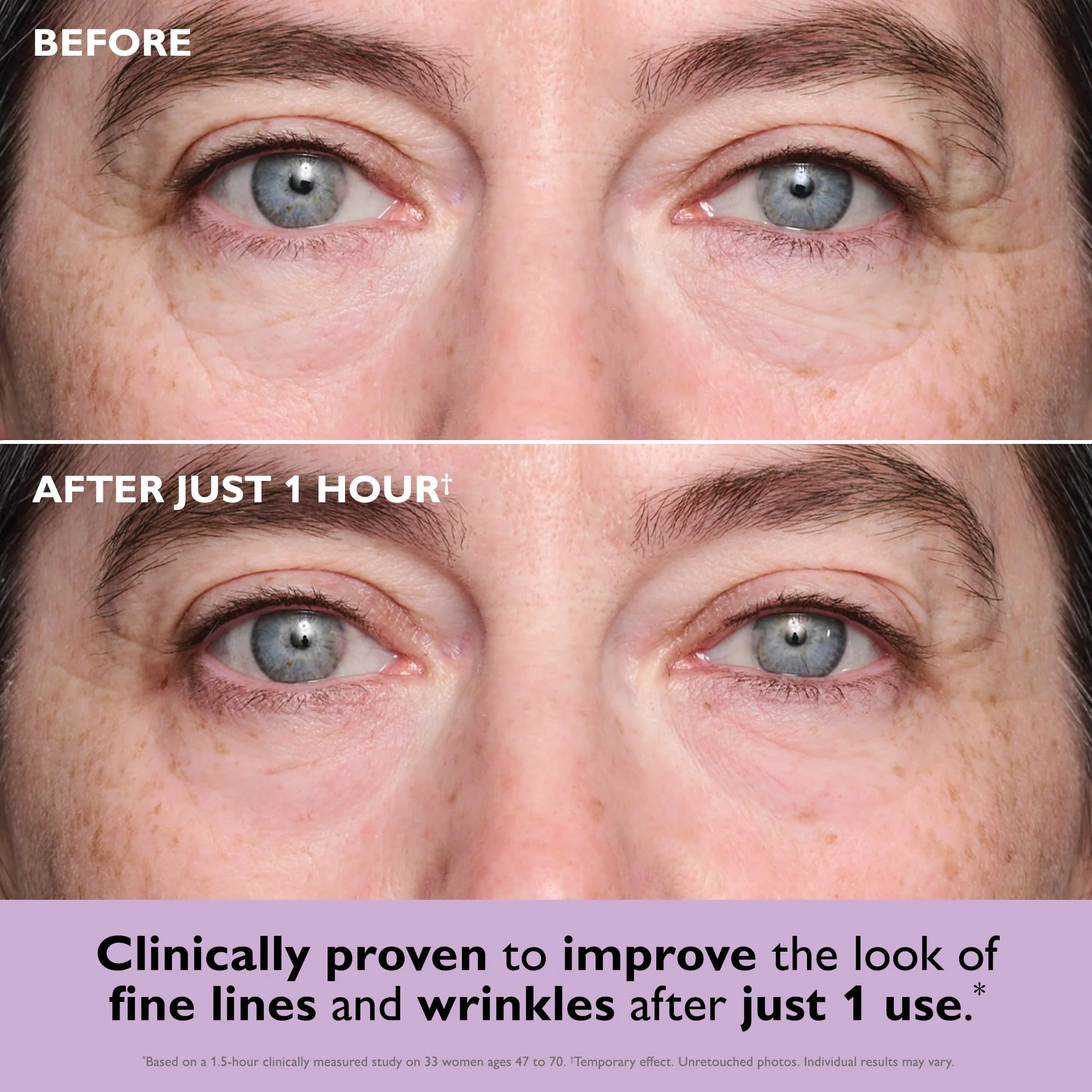Peter Thomas Roth | Instant FIRMx® Collagen Tightening Eye Patches | Eye Patches For Firming Under-Eye Bags & Wrinkles | Eye Masks For Puffiness - Image 6