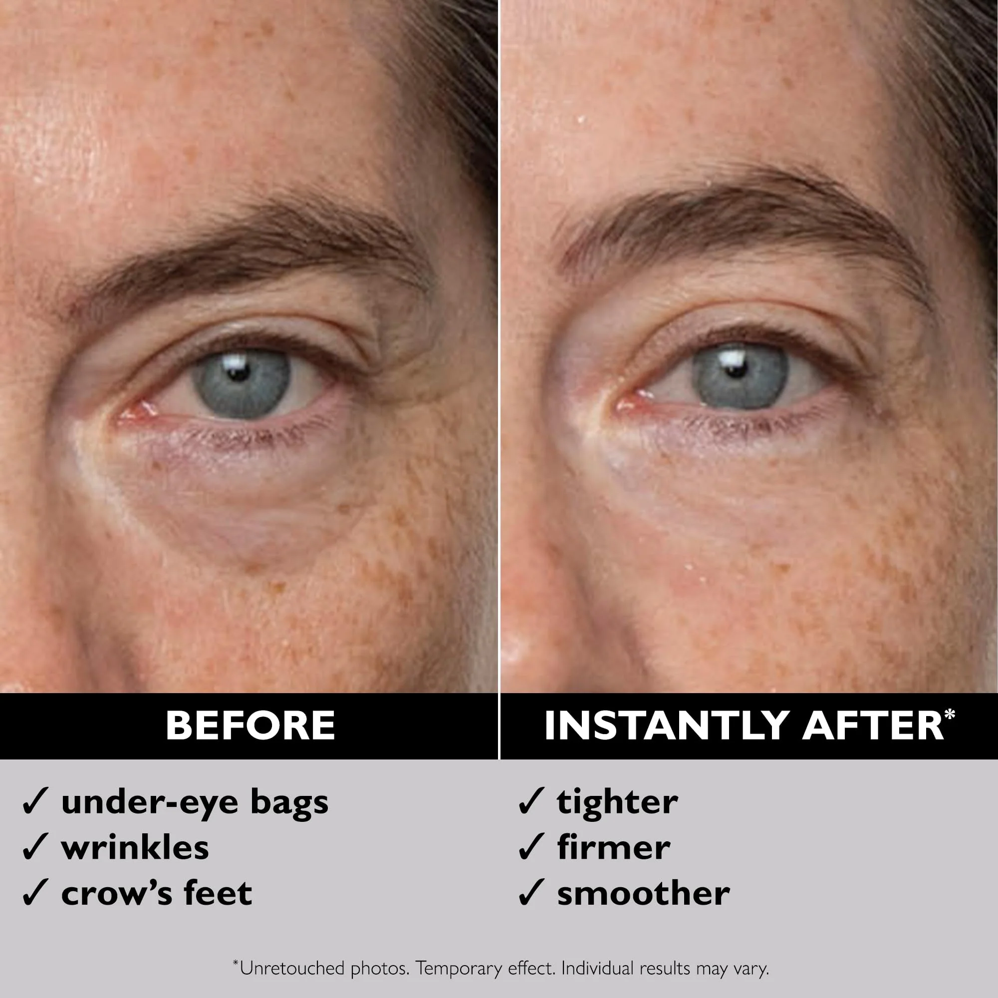 Peter Thomas Roth | Instant FIRMx® Eye Temporary Eye Tightener - Image 10