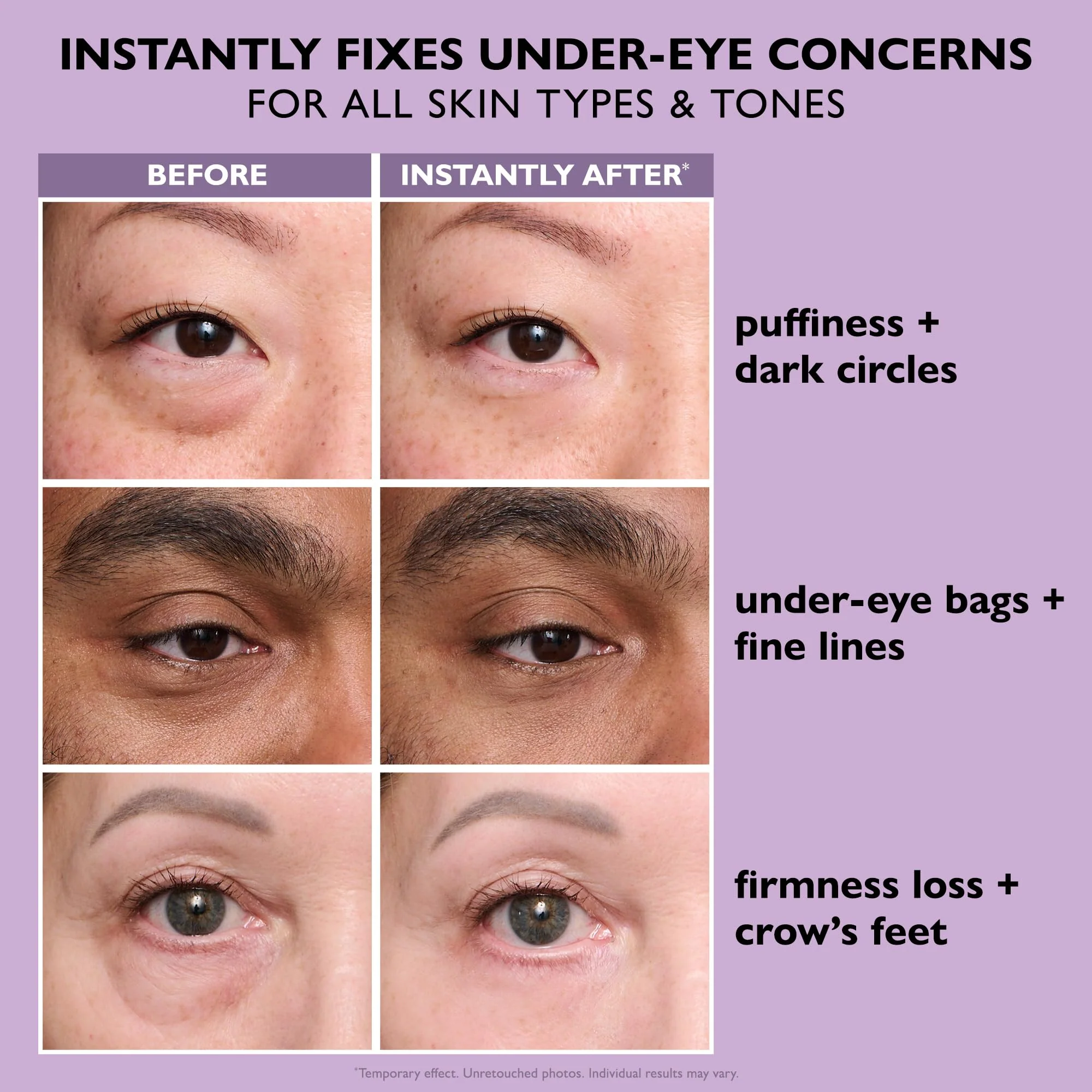 Peter Thomas Roth | Instant FIRMx® Eye Temporary Eye Tightener Easy-Wear Formula | For Firming Under-Eye Bags & Wrinkles - Image 5