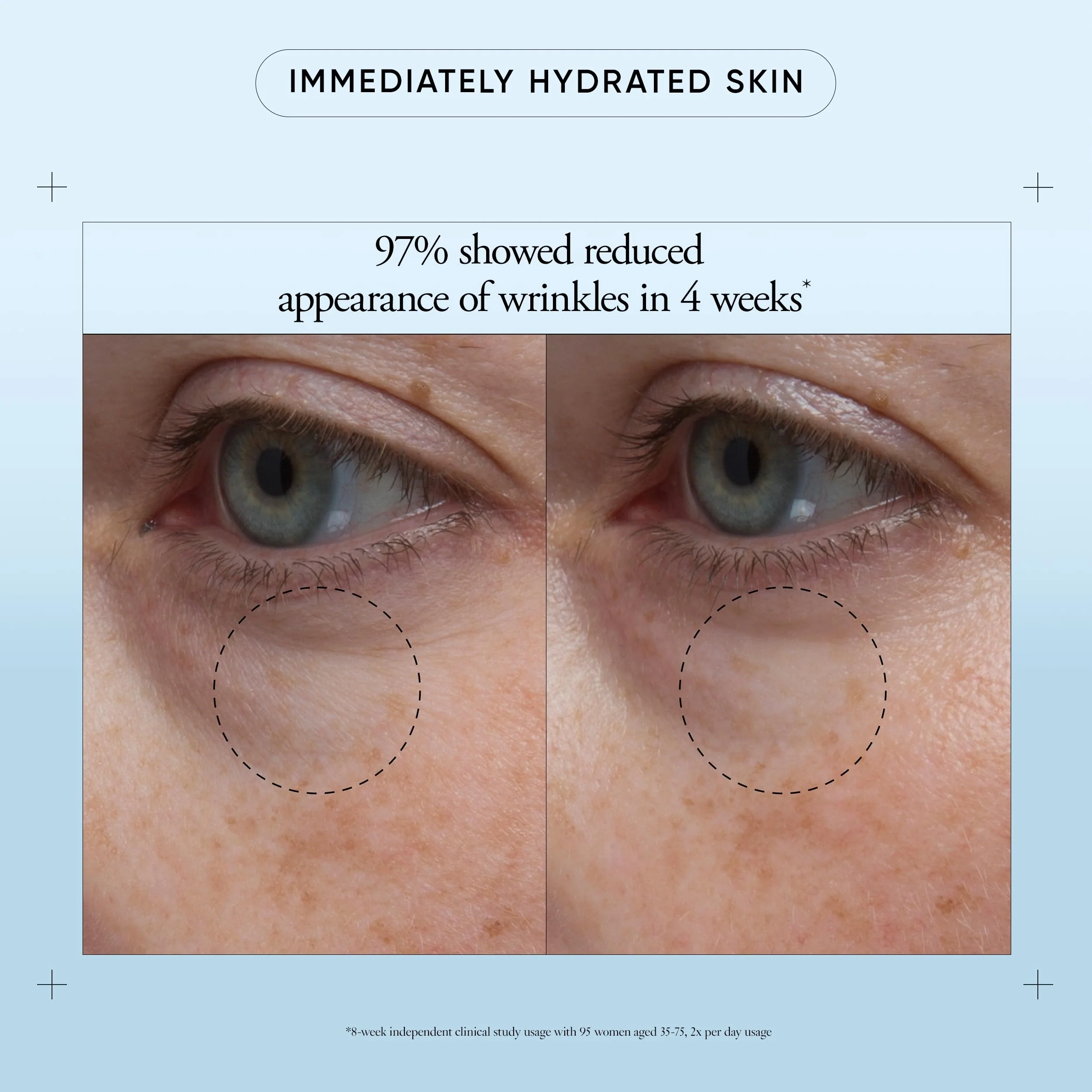 philosophy hope in a jar eye revival serum eye cream - with hyaluronic acid, elderberry extract & tangerine peel extract- hydrates and reduces puffiness - 0.5 fl oz - Image 2