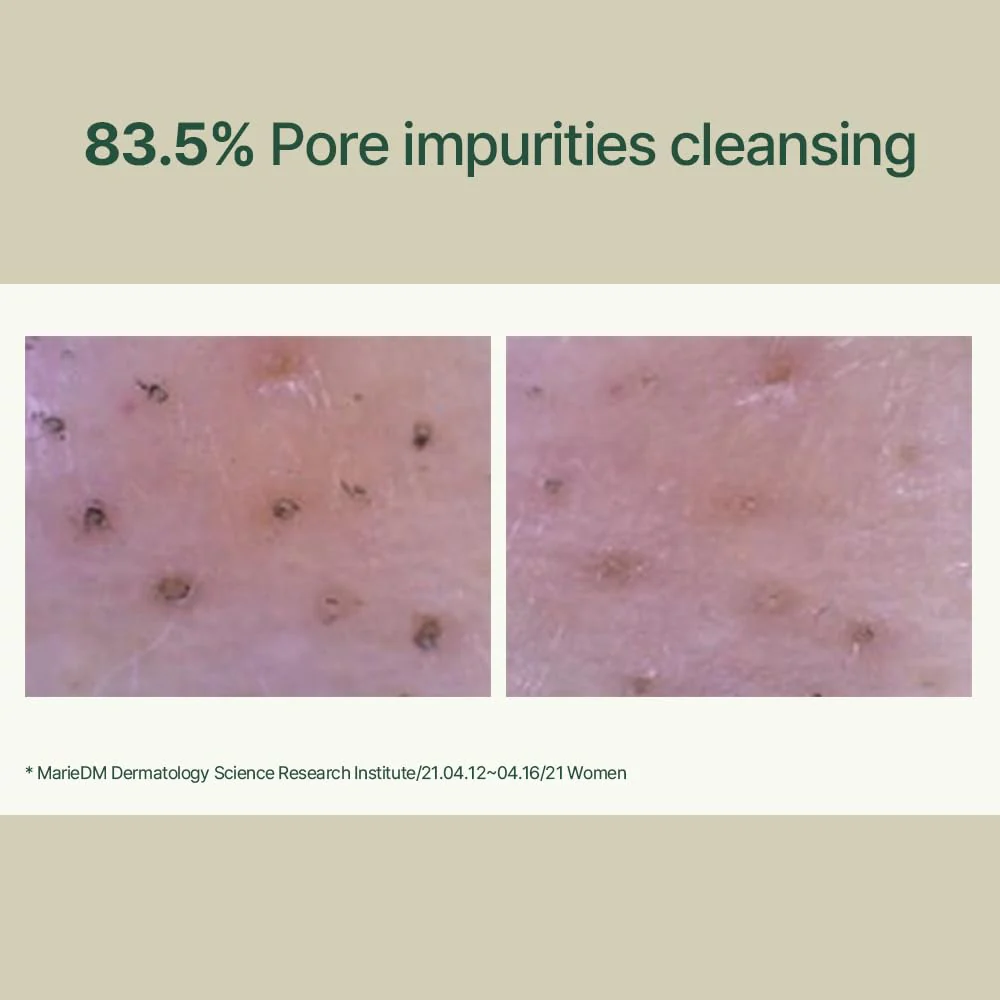 Pyunkang Yul PKY Calming Low pH Foaming Cleanser | Daily Face Wash & Makeup Remover with Tea Tree, Centella Asiatica, 5 Hyaluronic Acids that Removes Dead Skin Cells, Hydrates Skin - 150ml 5.07 Fl.Oz. - Image 5