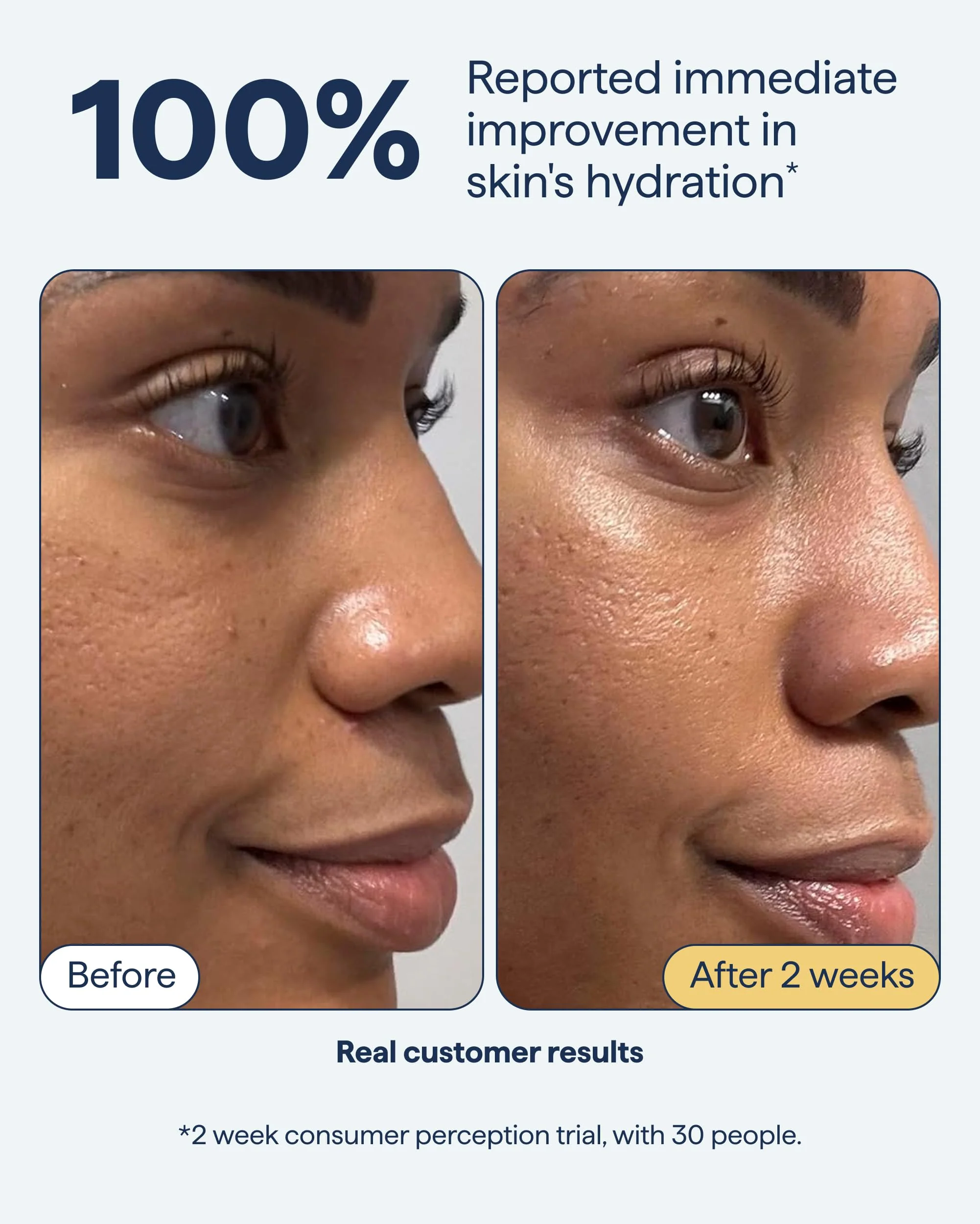 Remedy for Rich Moisture | Barrier Repairing Rich Cream Moisturizer for Normal to Dry Skin | Quadruple Ceramide Complex, Peptides, Squalane, Glycerin | By Dermatologist Dr. Shah, 1.7 fl. oz - Image 5