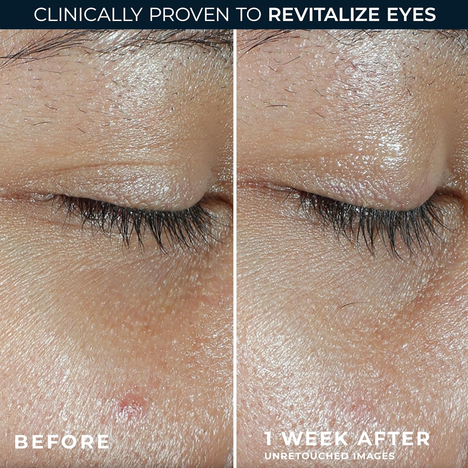 RoC Multi Correxion Revive + Glow Eye Balm with Vitamin C (0.14 oz) + Retinol Eye Cream Packette - Image 14