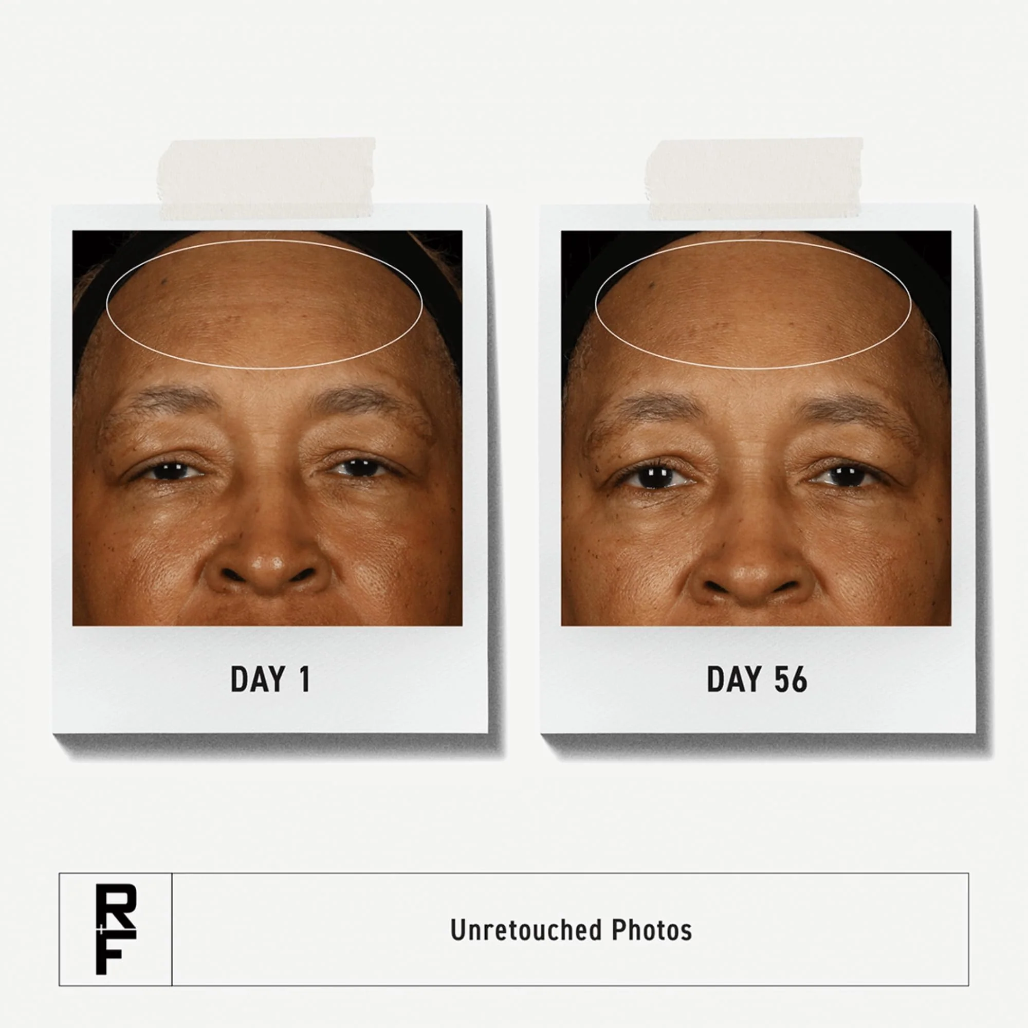 Rodan + Fields Redefine Pore Minimizing Toner 4.2 fl oz | Glycolic Acid Exfoliant for Smoother Skin | Pore Refining Toner | Deep Exfoliating Facial Routine - Image 8