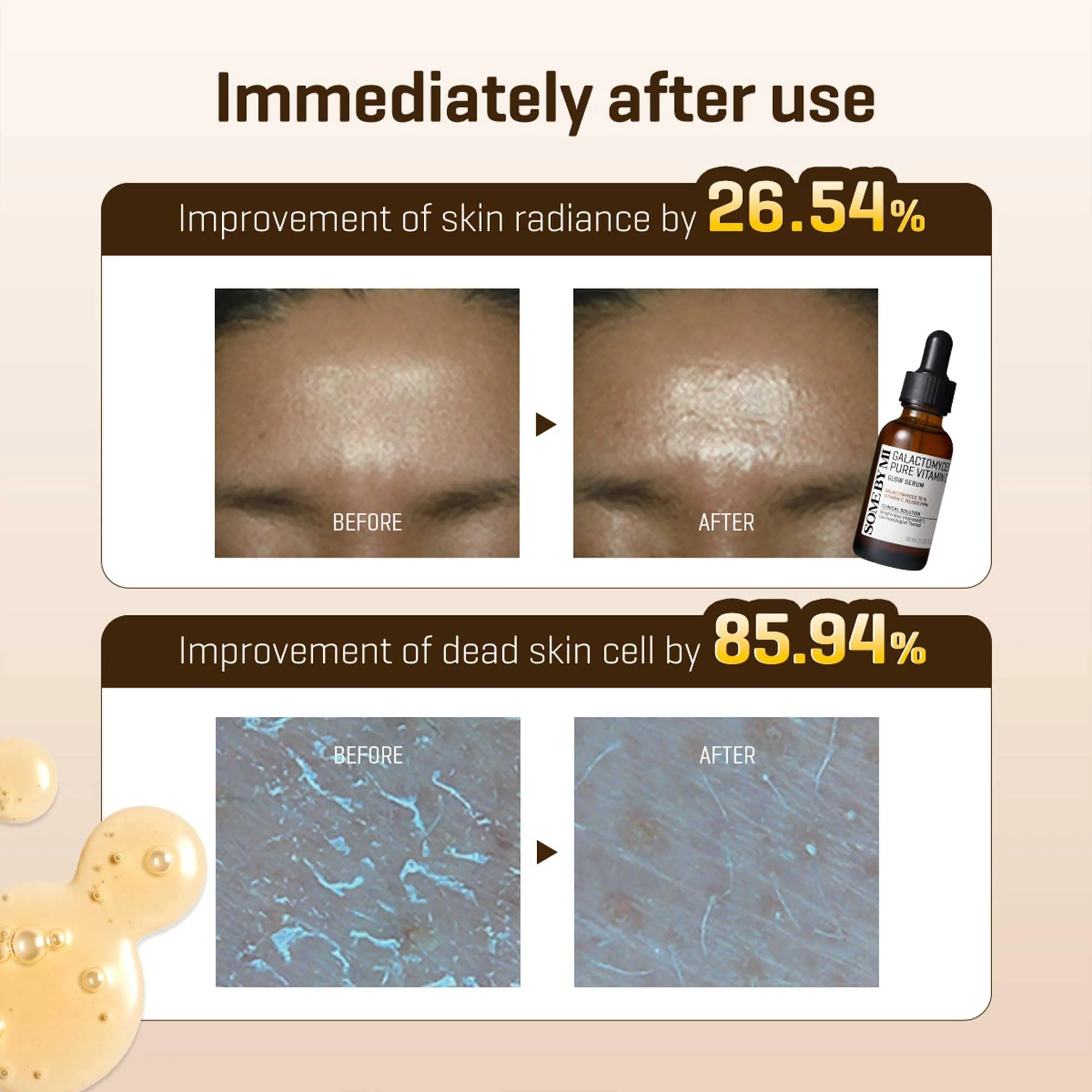 SOME BY MI Galactomyces Pure Vitamin C Glow Serum - 1.01Oz, 30ml - Korean Vitamin C Face Serum for Glow Glass Skin - Dark Spot Correcting Ampule with Brightening and Elasticity Care - Korean Skin Care - Image 3