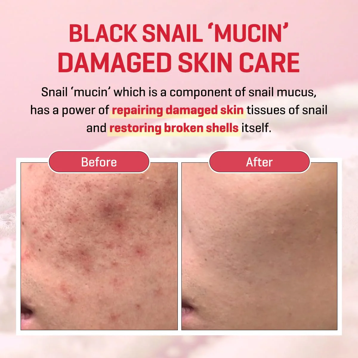 SOME BY MI Snail Truecica Miracle Repair Cream - 2.02Oz, 60ml - Made from Snail Mucin for Sensitive Skin - Daily Repair Face Moisturizer for Acne Marks and Strengthen Skin Barrier - Korean Skin Care - Image 5