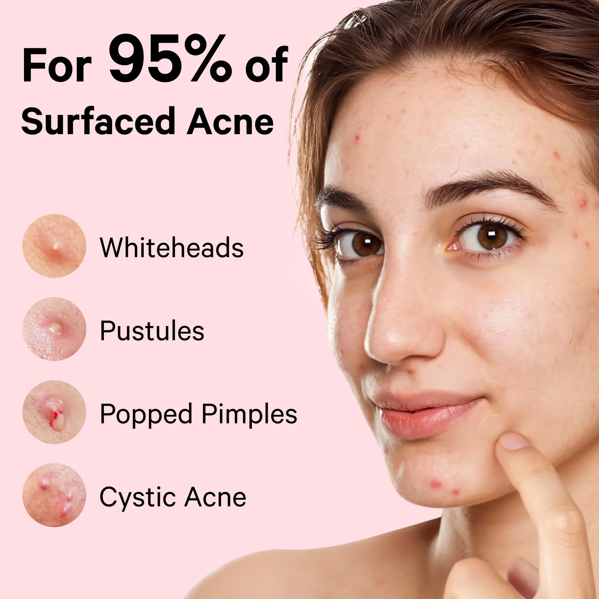 Sosky Pimple Patches for Face, Invisible Hydrocolloid Acne Patches, HSA Store Eligible Items, Zit Sticker for Face and Skin, Pimple Sticker for Covering Zits, Blemishes with Salicylic Acid 48 Count - Image 2
