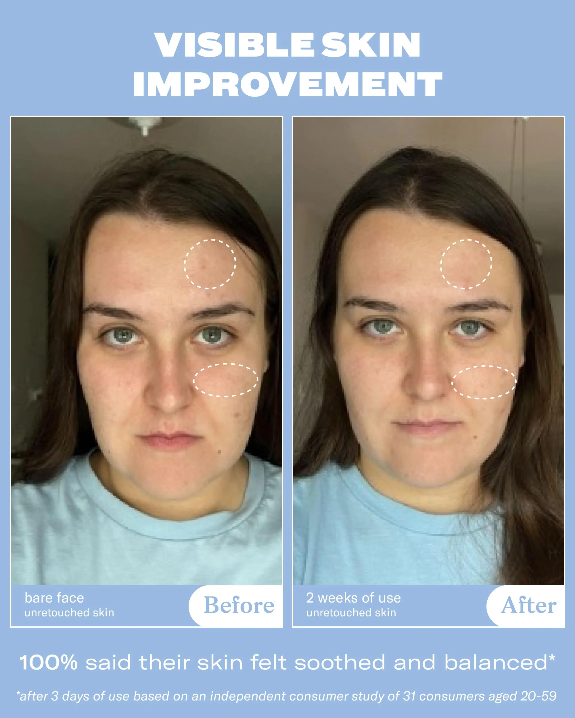 Then I Met You Renewing Rich Beauty Cream, Deep Hydration Korean Moisturizer with Quad Ginseng Complex, Fast Absorbing Vegan-Cruelty-Free Plant-Based Antioxidant, Alcohol Free Skincare for Exfoliated - Image 8