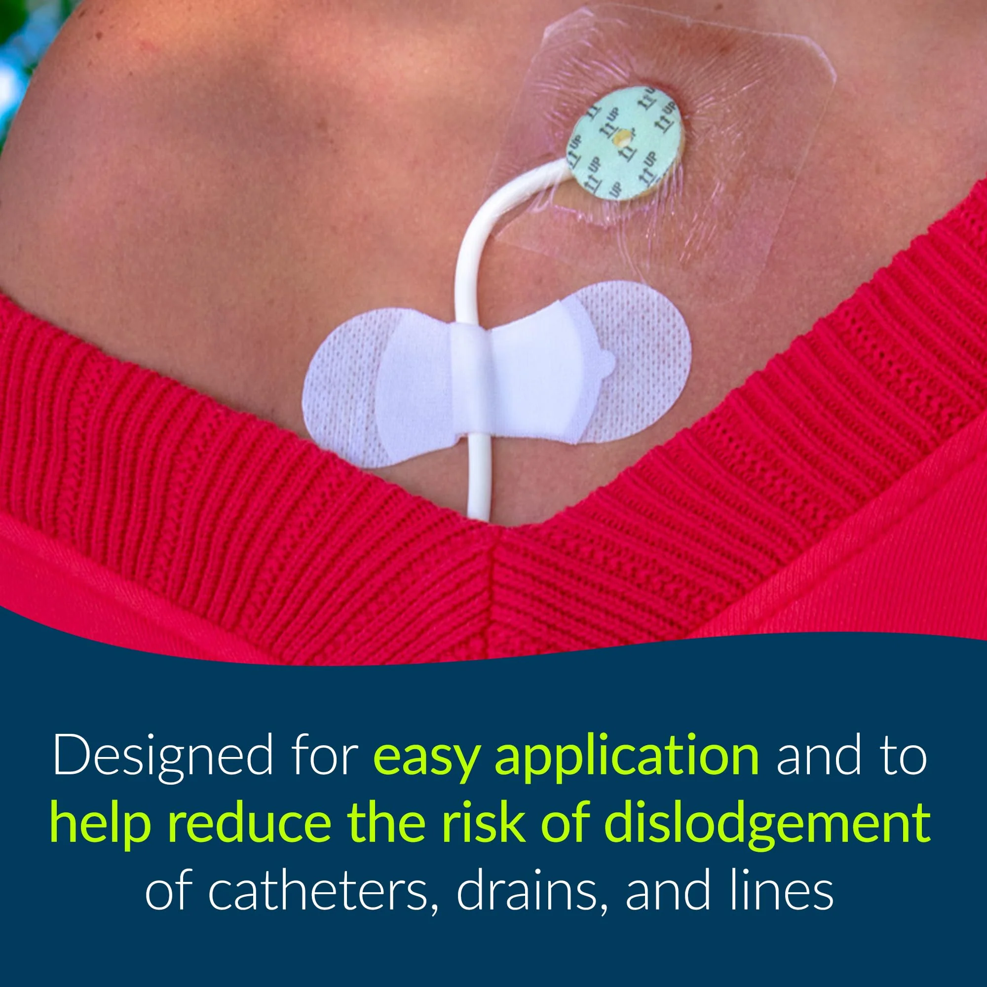 TIDI 3300M Grip-Lok Medium Securement Device ― Pack of 100 ― Catheter Stabilization Device ― White ― Flexible Material ― Low-Profile Design for Comfort― Home Healthcare ― Medical Supplies - Image 4