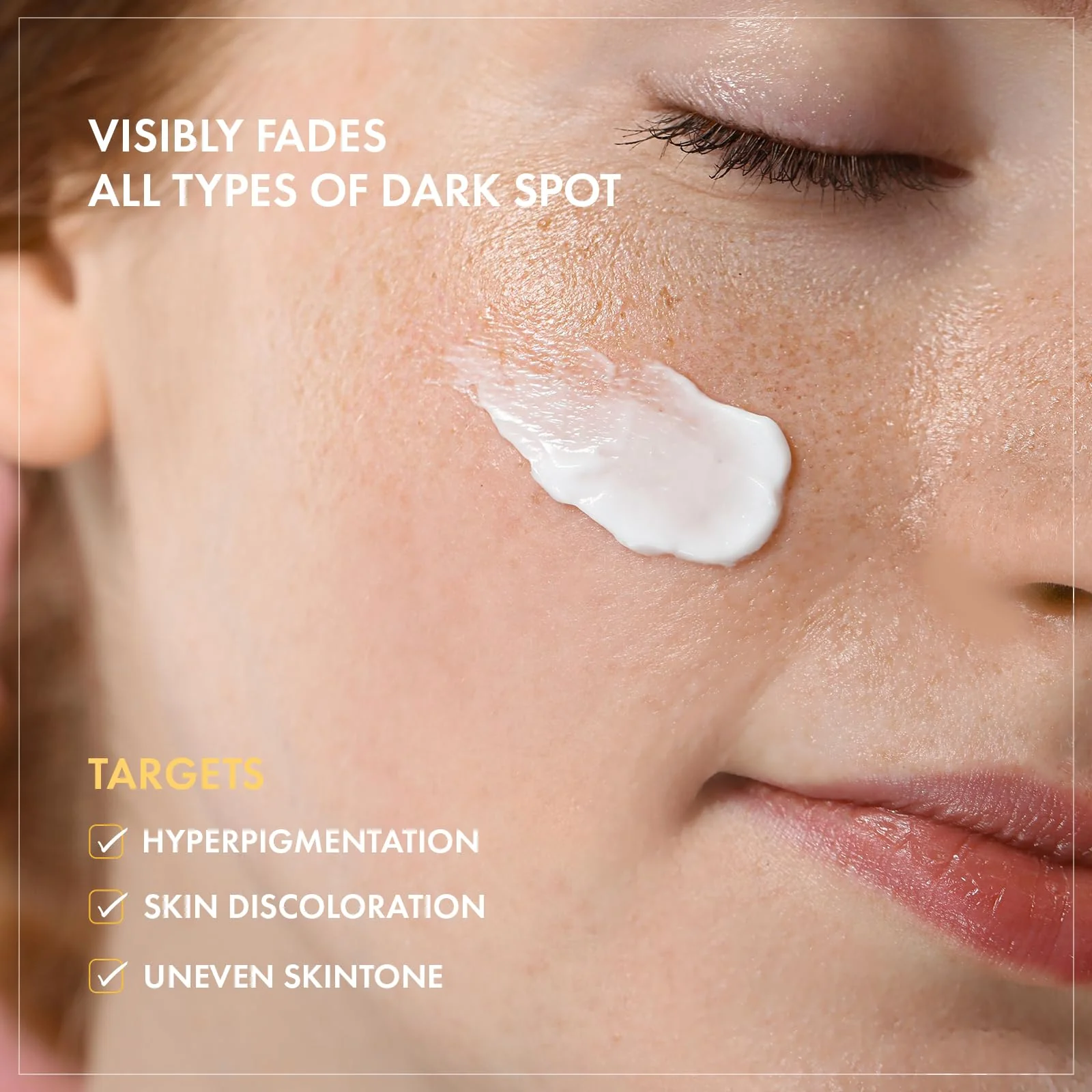 TOSOWOONG 8 Days Spot Cream, Dark Spot Remover for Face, Age Spot, Sun Spot, Freckles, Melasma, Brown Spot Serum, Advanced Formula Corrector Cream with Niacinamide for Women and Men, 50g, 1.76 oz. - Image 4