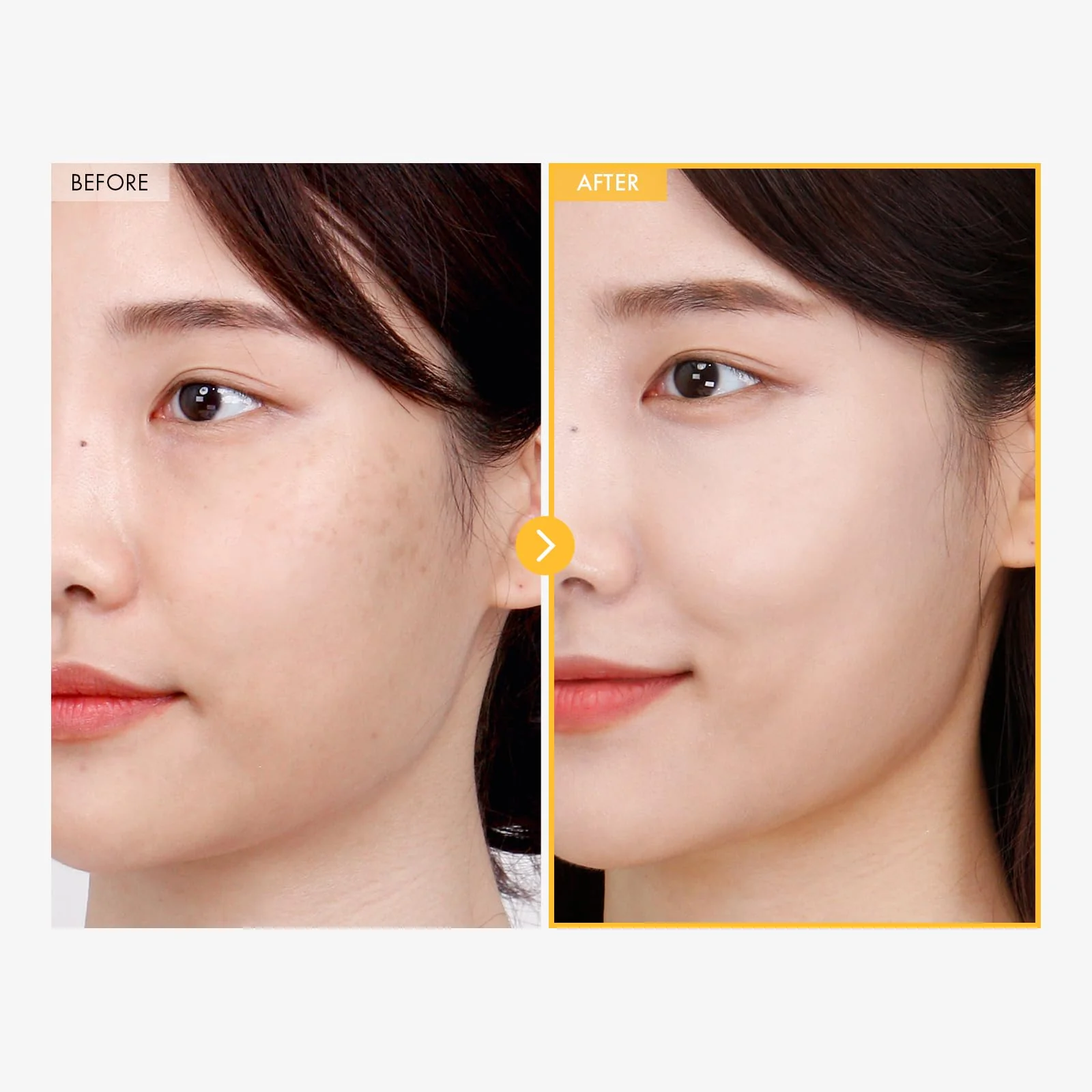 TOSOWOONG 8 Days Spot Cream, Dark Spot Remover for Face, Age Spot, Sun Spot, Freckles, Melasma, Brown Spot Serum, Advanced Formula Corrector Cream with Niacinamide for Women and Men, 50g, 1.76 oz. - Image 5