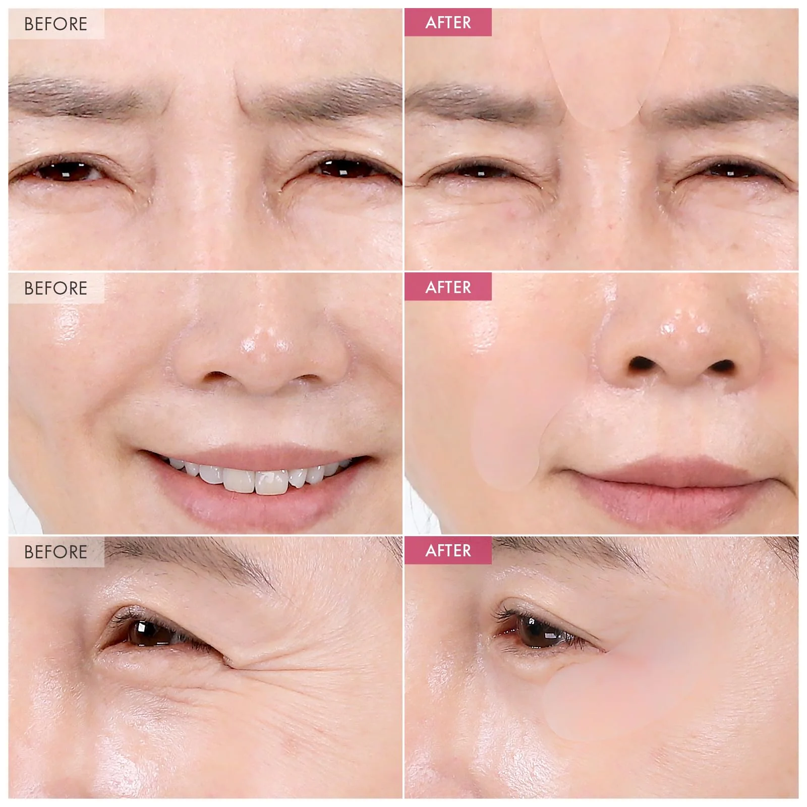 TOSOWOONG Anti-Wrinkle Patch with Hydrolyzed Collagen, Forehead & Eye & Smile Line Wrinkle Patches, Anti-Wrinkle Tape, K-Beauty Overnight Under Eye Patches, Korean Skincare, 5ea (10patches X 5) - Image 7