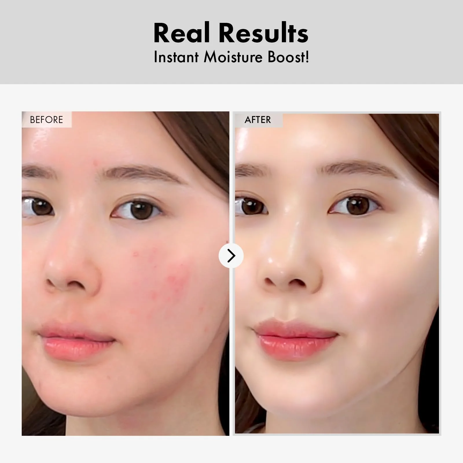 TOSOWOONG Hyaluronic Acid Ampoule, Hydrating Glow and Skin Barrier Protection, Anti-Aging Face Serum for Dry Skin, Korean Skincare Beauty Products, 100ml, 3.38 fl. oz. - Image 7