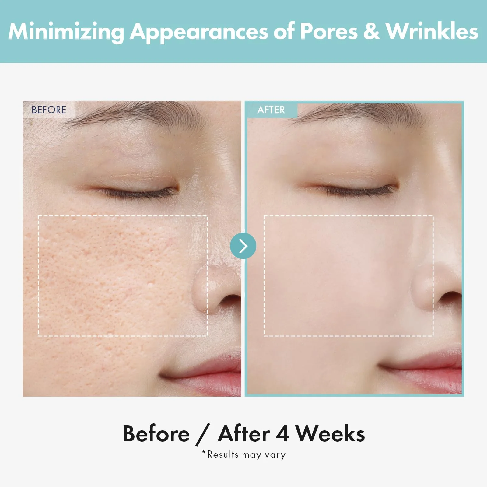 TOSOWOONG Pore Refiner Cream, Pore Minimizer with AHA - Glycolic Acid and Lactic Acid, Oil Control Face Moisturizer for Oily Skin, Texture Smoothing for Fine Lines, Korean Skincare, 50g / 1.76 oz. - Image 6