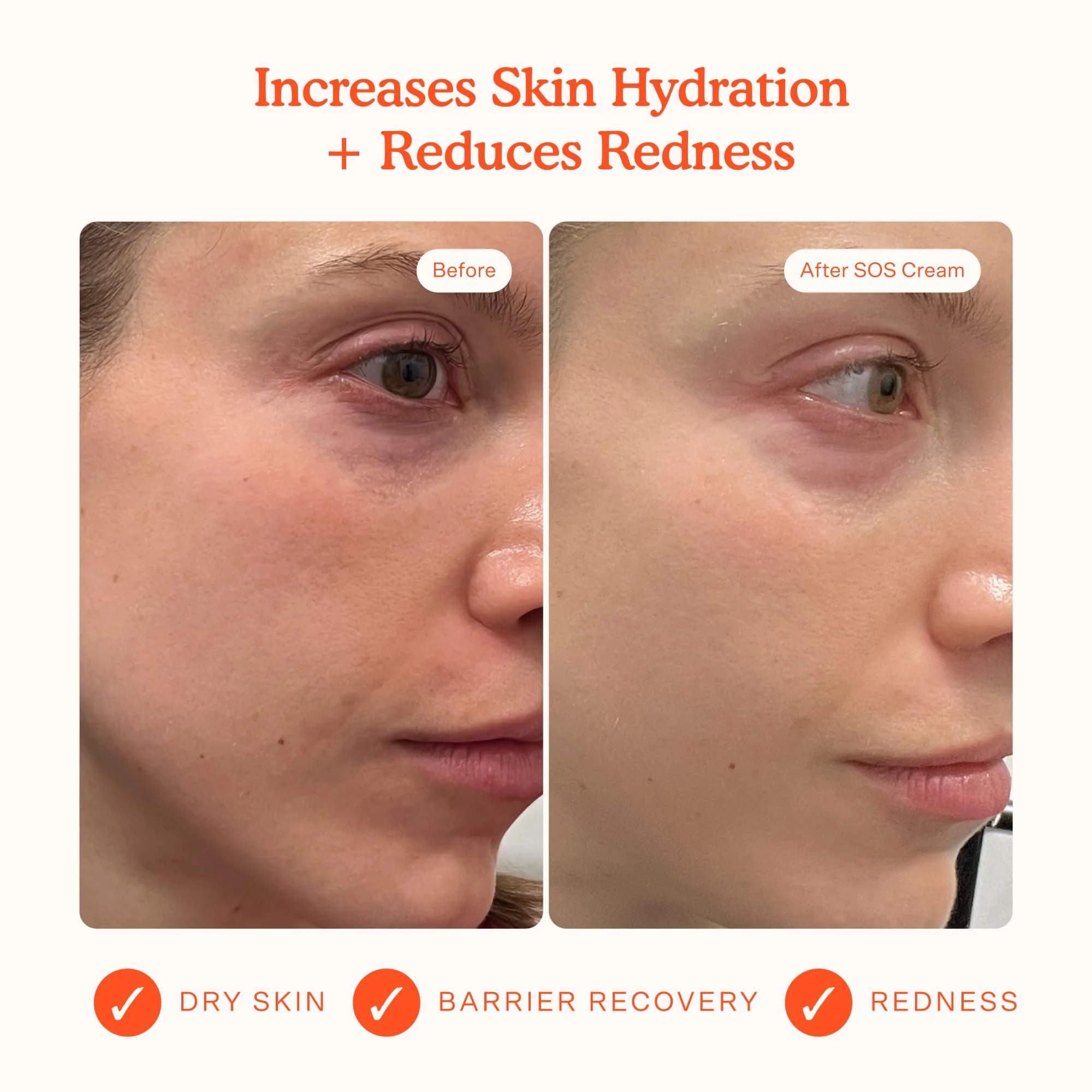 Tower 28 SOS Recovery Face Cream - Hydrating Face Moisturizer with Hyaluronic Acid + Ceramides - Skin Barrier Repair Moisturizer Reduces Redness + Improves Texture - Sensitive Skin Care (1.86 oz) - Image 9