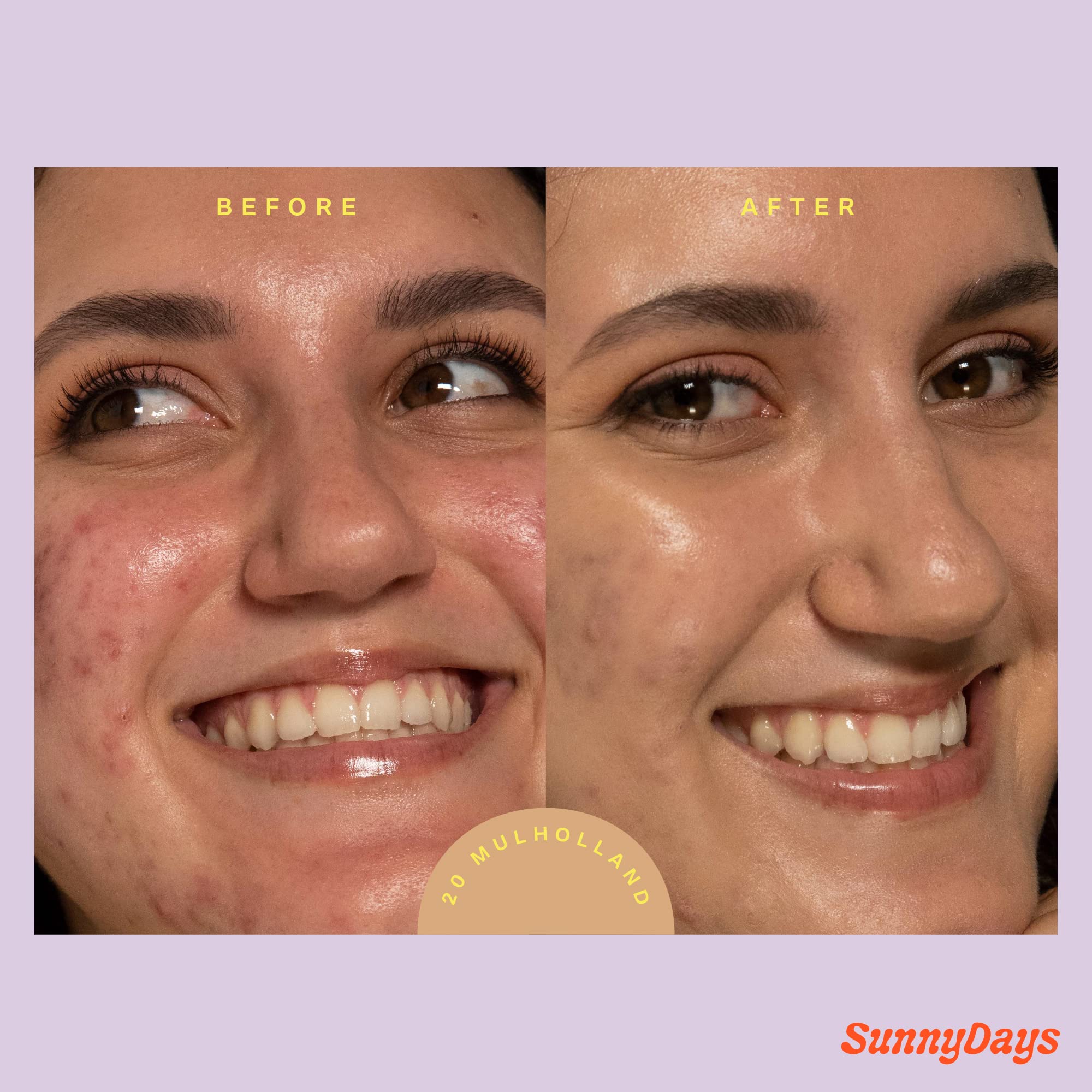Tower 28 SunnyDays SPF 30 Tinted Moisturizer - 2-in-1 Buildable Coverage Foundation + Mineral Sunscreen for Face - Zinc Oxide, Aloe & Prickly Pear for Sensitive Skin - 20 Light/Golden Neutral (1 oz) - Image 3