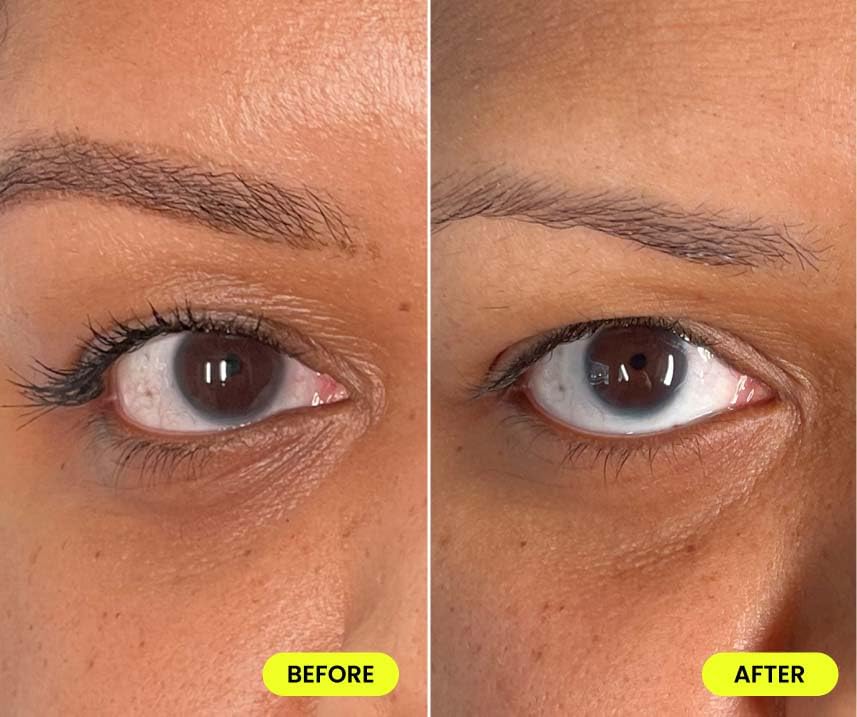 Urban Skin Rx® Dark Circle Vitaleyez Nighttime Eye Treatment Cream, Smooths & Brightens the Look of Tired Puffy Under-Eyes, Targets Dark Circles & Fine Lines with Caffeine & Hyaluronic Acid, 0.5 Oz - Image 6