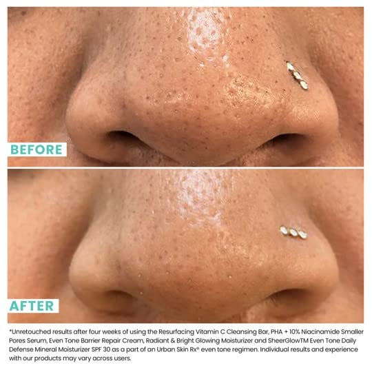 Urban Skin Rx® PHA + 10% Niacinamide Smaller Pores Serum, Tightens Pores for Clear, Brighter & Smoother Skin, Exfoliates, Decongests, Controls Excess Oil, & Fights Against Future Breakouts, 1 Fl Oz. - Image 5