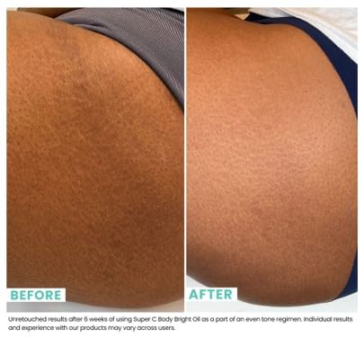 Urban Skin Rx® Pro Strength Super C Hydrating Body Bright Oil, Brightens, Nourishes & Rejuvenates for Smooth, Glowing Skin, Improves Appearance of Scars, Aging, Discoloration & Stretch Marks, 4 Fl Oz - Image 4