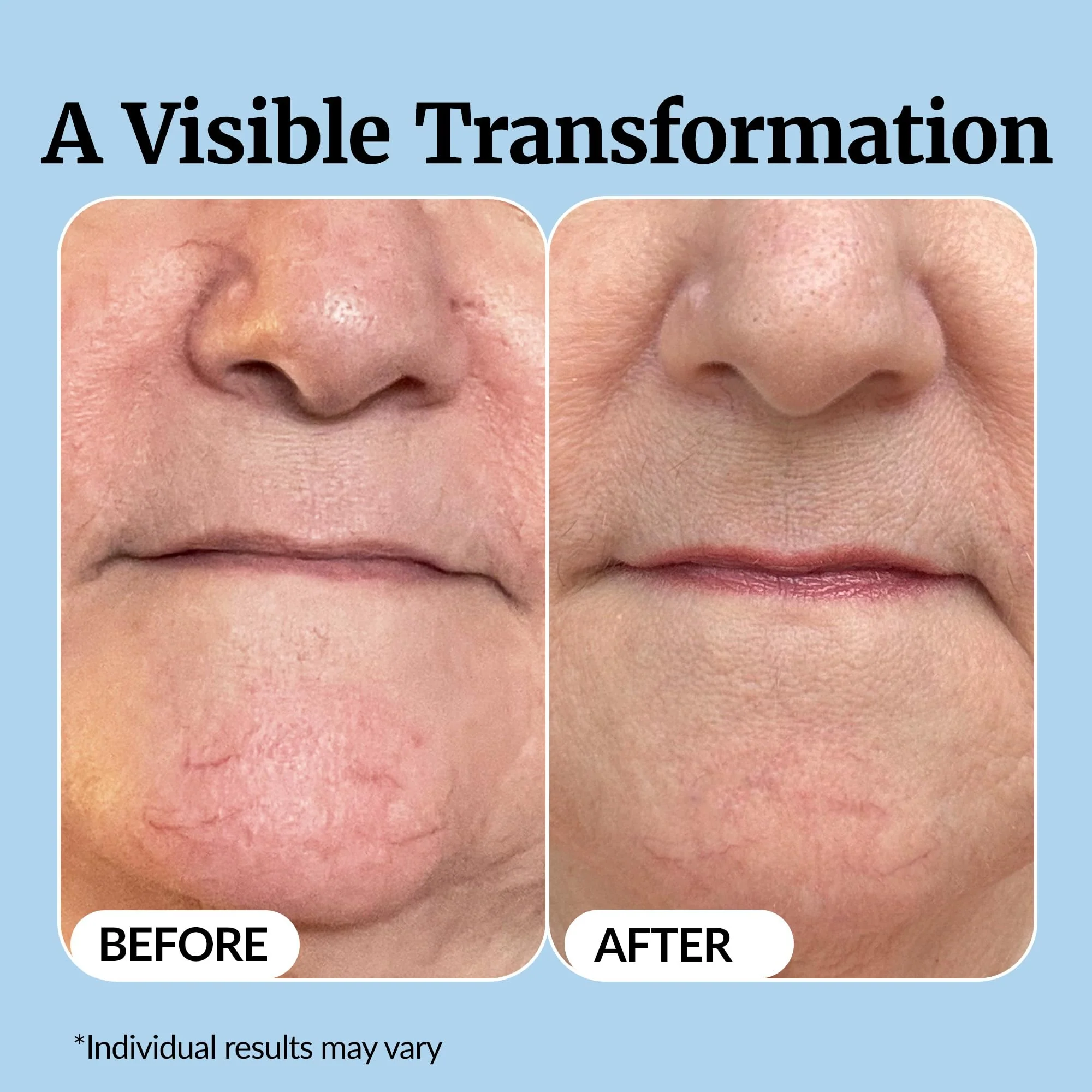 Vibriance Super C Serum for Mature Skin - All-in-One Vitamin Formula Hydrates, Firms, Lifts, Smooths, Targets Age Spots, Wrinkles, 1 fl oz - Image 5