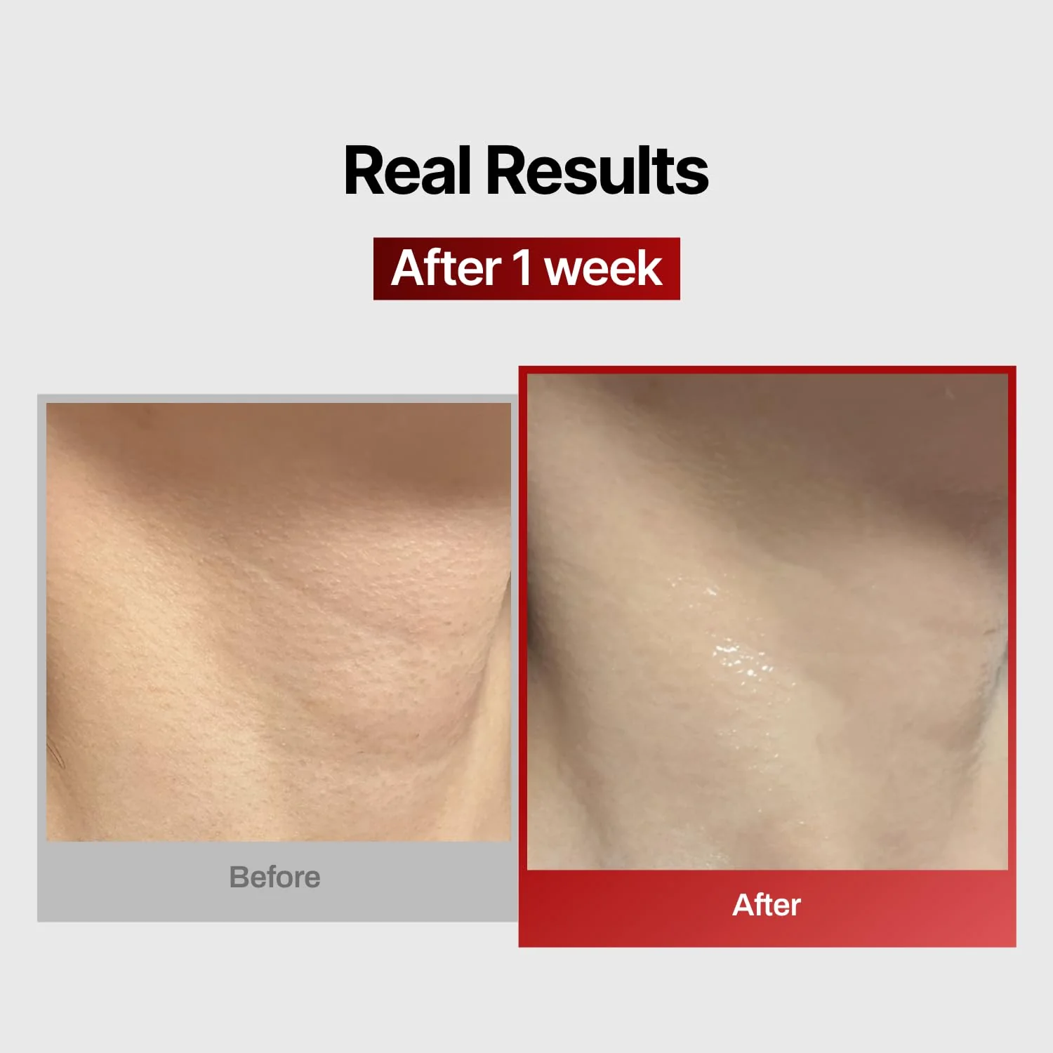 Wrinkle-fit Neck Mask - Neck Wrinkle Patches, Firming and Tightening Korean Deep Collagen Masks - Hyaluronic Acid NeckTargeted Mesh Sheet Mask for Lifting Sagging Skin - Boosting Elasticity 7EA - Image 8